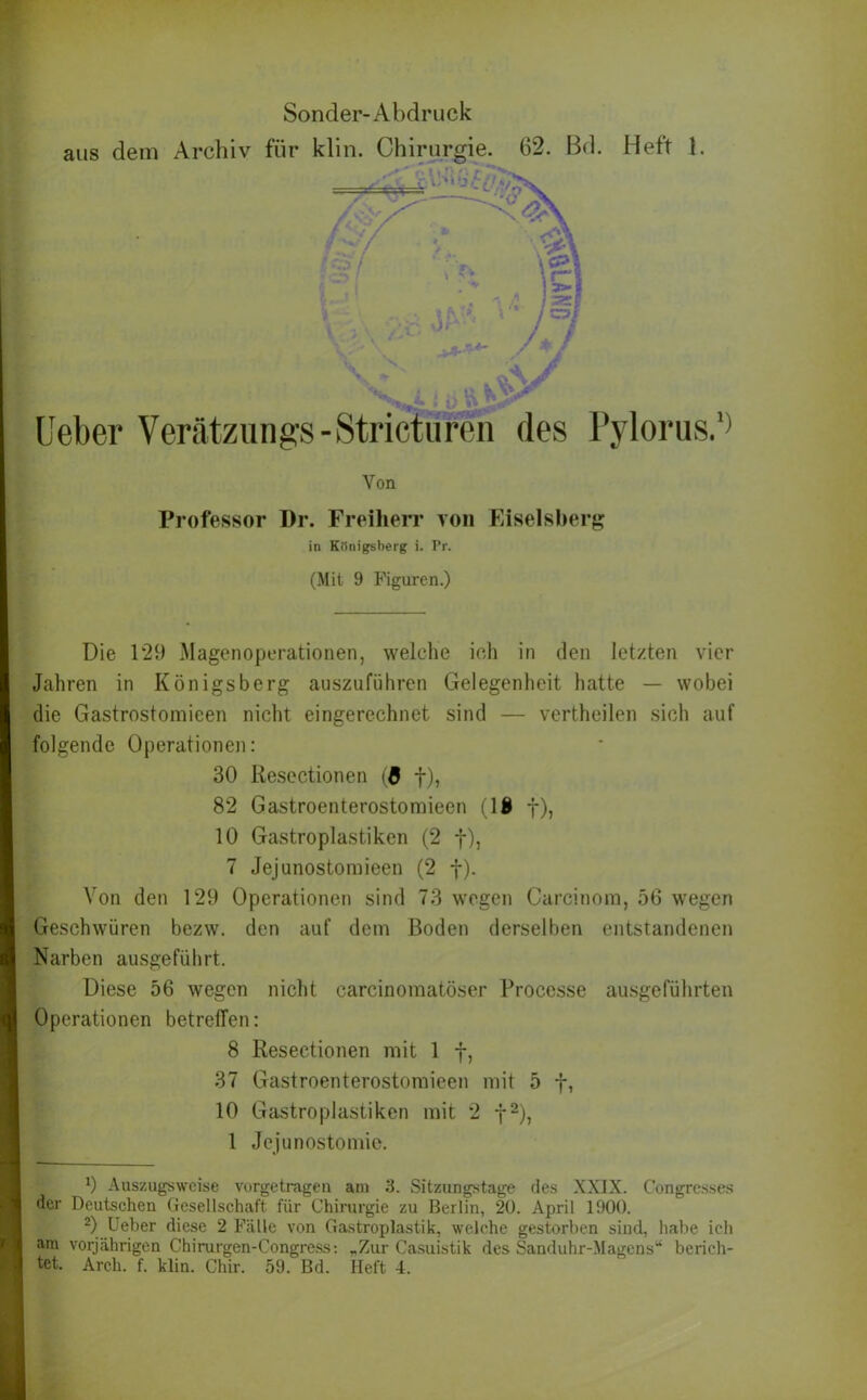 aus dem Archiv für klin. Chirurgie. 62. ßd. Heft 1. '  -•-CV^V >\ : i ■ a j*-* ' 7=7 . r.*- / 3k / \ ; b ft Ueber Verätzungs-Stricturen des Pylorus.1' Von Professor Dr. Freiherr von Eiseisberg in Königsberg i. Pr. (Mit 9 Figuren.) Die 129 Magenoperationen, welche ich in den letzten vier Jahren in Königsberg auszuführen Gelegenheit hatte — wobei die Gastrostomieen nicht eingerechnet sind — vertheilen sich auf folgende Operationen: 30 Resectionen (ff f), 82 Gastroenterostomieen (1® f), 10 Gastroplastiken (2 f), 7 Jejunostomieen (2 f). Von den 129 Operationen sind 73 wegen Carcinom, 56 wegen Geschwüren bezw. den auf dem Boden derselben entstandenen Narben ausgeführt. Diese 56 wegen nicht carcinomatöser Processe ausgeführten Operationen betreffen: 8 Resectionen mit 1 f, 37 Gastroenterostomieen mit 5 f, 10 Gastroplastiken mit 2 j2), 1 Jejunostomie. 1 !) Auszugsweise vorgetragen am 3. Sitzungstage des XXIX. Congrcsses der Deutschen Gesellschaft für Chirurgie zu Berlin, 20. April 1900. 2) Ueber diese 2 Fälle von Gastroplastik, welche gestorben sind, habe ich am vorjährigen Chirurgen-Congress: „Zur Casuistik des Sanduhr-Magens“ berich- tet. Arch. f. klin. Chir. 59. Bd. Heft 4.