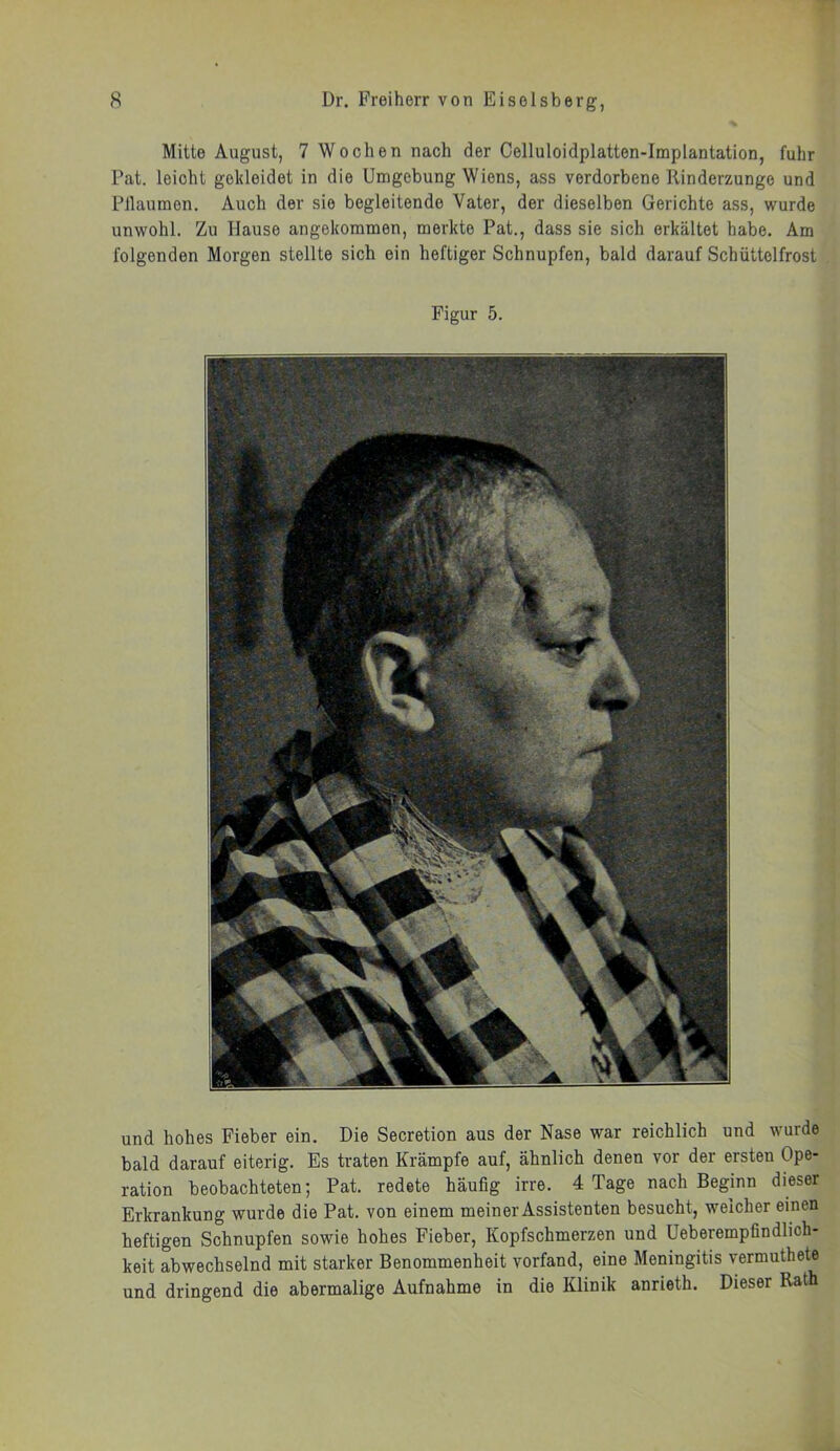 Mitte August, 7 Wochen nach der Celluloidplatten-Implantation, fuhr Pat. leicht gekleidet in die Umgebung Wiens, ass verdorbene Rinderzunge und Pflaumen. Auch der sie begleitende Vater, der dieselben Gerichte ass, wurde unwohl. Zu Hause angekommen, merkte Pat., dass sie sich erkältet habe. Am folgenden Morgen stellte sich ein heftiger Schnupfen, bald darauf Schüttelfrost Figur 5. und hohes Fieber ein. Die Secretion aus der Nase war reichlich und wurde bald darauf eiterig. Es traten Krämpfe auf, ähnlich denen vor der ersten Ope- ration beobachteten; Pat. redete häufig irre. 4 Tage nach Beginn dieser Erkrankung wurde die Pat. von einem meiner Assistenten besucht, weicher einen heftigen Schnupfen sowie hohes Fieber, Kopfschmerzen und Ueberempfindlich- keit abwechselnd mit starker Benommenheit vorfand, eine Meningitis vermuthete und dringend die abermalige Aufnahme in die Klinik anrieth. Dieser Rath