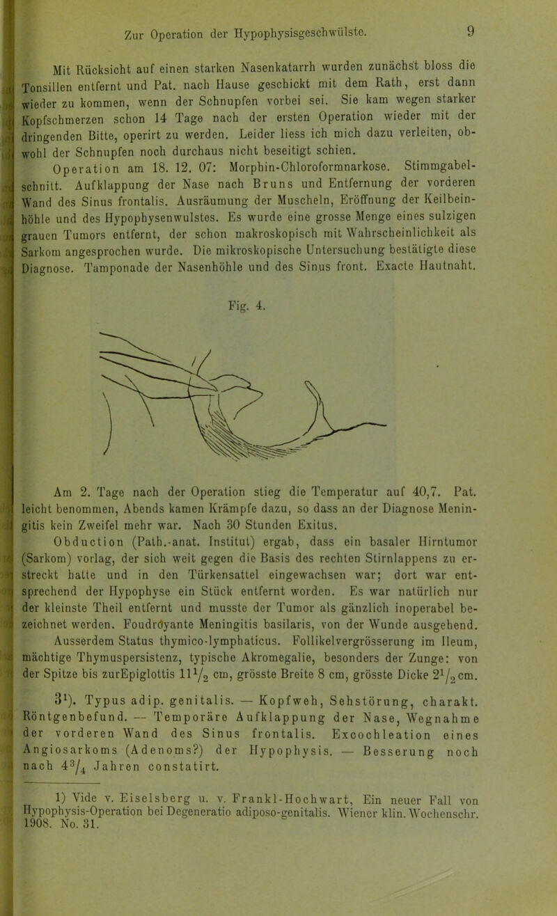 Mit Rücksicht auf einen starken Nasenkatarrh wurden zunächst bloss die Tonsillen entfeint und Pat, nach Hause geschickt mit dem Rath, erst dann wieder zu kommen, wenn der Schnupfen vorbei sei. Sie kam wegen starker Kopfschmerzen schon 14 Tage nach der ersten Operation wieder mit der dringenden Bitte, operirt zu werden. Leider Hess ich mich dazu verleiten, ob- wohl der Schnupfen noch durchaus nicht beseitigt schien. Operation am 18. 12. 07: Morphin-Chloroformnarkose. Stimmgabel- schnitt. Aufklappung der Nase nach Bruns und Entfernung der vorderen Wand des Sinus frontalis. Ausräumung der Muscheln, Eröffnung der Keilbein- höhle und des Hypophysenwulstes. Es wurde eine grosse Menge eines sulzigen grauen Tumors entfernt, der schon makroskopisch mit Wahrscheinlichkeit als Sarkom angesprochen wurde. Die mikroskopische Untersuchung bestätigte diese Diagnose. Tamponade der Nasenhöhle und des Sinus front. Exacte Hautnaht. Fig. 4. Am 2. Tage nach der Operation stieg die Temperatur auf 40,7. Pat. leicht benommen, Abends kamen Krämpfe dazu, so dass an der Diagnose Menin- gitis kein Zweifel mehr war. Nach 30 Stunden Exitus. Obduction (Path.-anat. Institut) ergab, dass ein basaler Hirntumor (Sarkom) vorlag, der sich weit gegen die Basis des rechten Stirnlappens zu er- streckt halte und in den Türkensattel eingewachsen war; dort war ent- sprechend der Hypophyse ein Stück entfernt worden. Es war natürlich nur der kleinste Theil entfernt und musste der Tumor als gänzlich inoperabel be- zeichnet worden. Foudrdyante Meningitis basilaris, von der Wunde ausgehend. Ausserdem Status thymico-lymphaticus. Follikelvergrösserung im Heum, mächtige Thymuspersistenz, typische Akromegalie, besonders der Zunge: von der Spitze bis zurEpigloltis 11 Yg cm, grösste Breite 8 cm, grösste Dicke 2i/qcm. 3^). Typus adip. genitalis. — Kopfweh, Sehstörung, charakt. Röntgenbefund. — Temporäre Aufklappung der Nase, Wegnahme der vorderen Wand des Sinus frontalis. Excochleation eines Angiosarkoms (Adenoms?) der Ilypophysis. — Besserung noch nach 4^4 Jahren constatirt. 1) Vide v. Eiseisberg u. v. Frankl-Hochwart, Ein neuer Fall von Hypophysis-Operation bei Degeneratio adiposo-genitalis. Wiener klin. Wochenschr. 1908. No. 31.