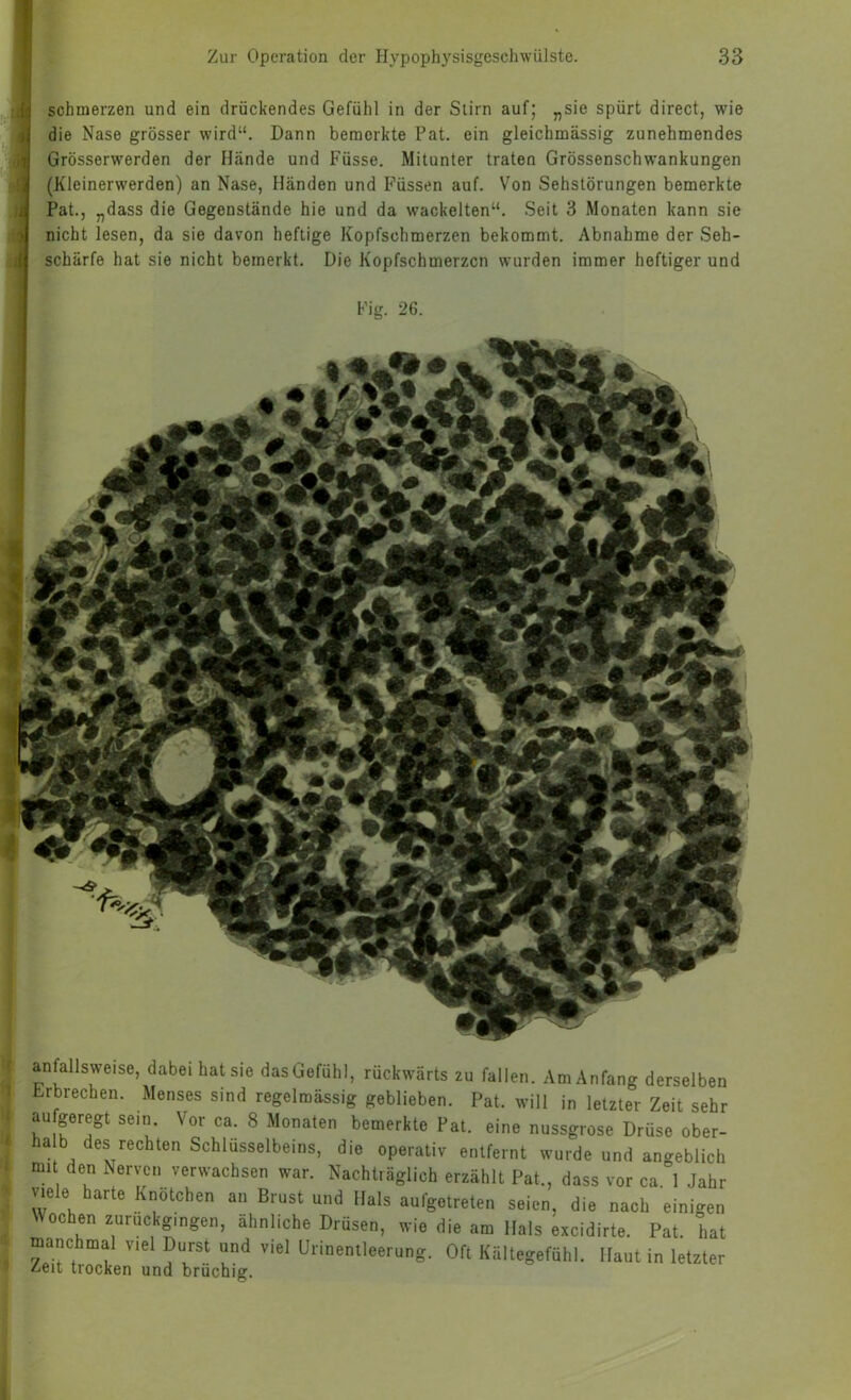 schmerzen und ein drückendes Gefühl in der Stirn auf; „sie spürt direct, wie . die Nase grösser wird“. Dann bemerkte Fat. ein gleichmässig zunehmendes I Grösserwerden der Hände und Füsse. Mitunter traten Grössenschwankungen ^ (Kleinerwerden) an Nase, Händen und Füssen auf. Von Sehstörungen bemerkte ; Pat., „dass die Gegenstände hie und da wackelten“. Seit 3 Monaten kann sie t nicht lesen, da sie davon heftige Kopfschmerzen bekommt. Abnahme der Seh- schärfe hat sie nicht bemerkt. Die Kopfschmerzen wurden immer heftiger und Fig. 26. anfallsweise, dabei hat sie das Gefühl, rückwärts zu fallen. Am Anfang derselben brbrechen. Menses sind regelmässig geblieben. Pat. will in letzter Zeit sehr aufgeregt sein Vor ca. 8 Monaten bemerkte Pat. eine nussgrose Drüse ober- la b des rechten Schlüsselbeins, die operativ entfernt wurde und angeblich den Nerven verwachsen war. Nachträglich erzählt Pat., dass vor ca 1 Jahr viele barte Knötchen an Brust und Hals aufgetreten seien, die nach einigen Vochen zuruckgmgen, ähnliche Drüsen, wie die am Hals excidirte. Pat. hat manchmal viel Durst und viel Urinentleerung. Oft Kältegefühl. Haut in letzter ^eit trocken und brüchig.