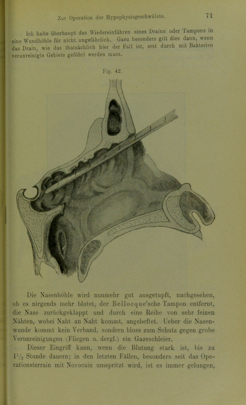 Ich halte überhaupt das Wiedereinfuhren eines Drains oder Tampons in i eine Wundhöhle für nicht ungefährlich. Ganz besonders gilt dies dann, wenn das Drain, wie das thatsächlich hier der Fall ist, erst durch mit Bakterien i verunreinigte Gebiete geführt werden muss. I 5 Fig. 42. Die Nasenhöhle wird nunmehr gut ausgetupft, nachgeselien, 1 ob es nirgends mehr blutet, der Bellocque’sche Tampon entfernt, ; die Nase zurückgeklappt und durch eine Reihe von sehr feinen \ Nähten, wobei Naht an Naht kommt, angeheftet, üeber die Nasen- wunde kommt kein Verband, sondern bloss zum Schutz gegen grobe Verunreinigungen (Fliegen u. dergl.) ein Gazeschleier, Dieser Eingriff kann, wenn die Blutung stark ist, bis zu D/o Stunde dauern; in den letzten Fällen, besonders seit das Ope- - rationsterrain mit Novocain umspritzt wird, ist es immer gelungen.