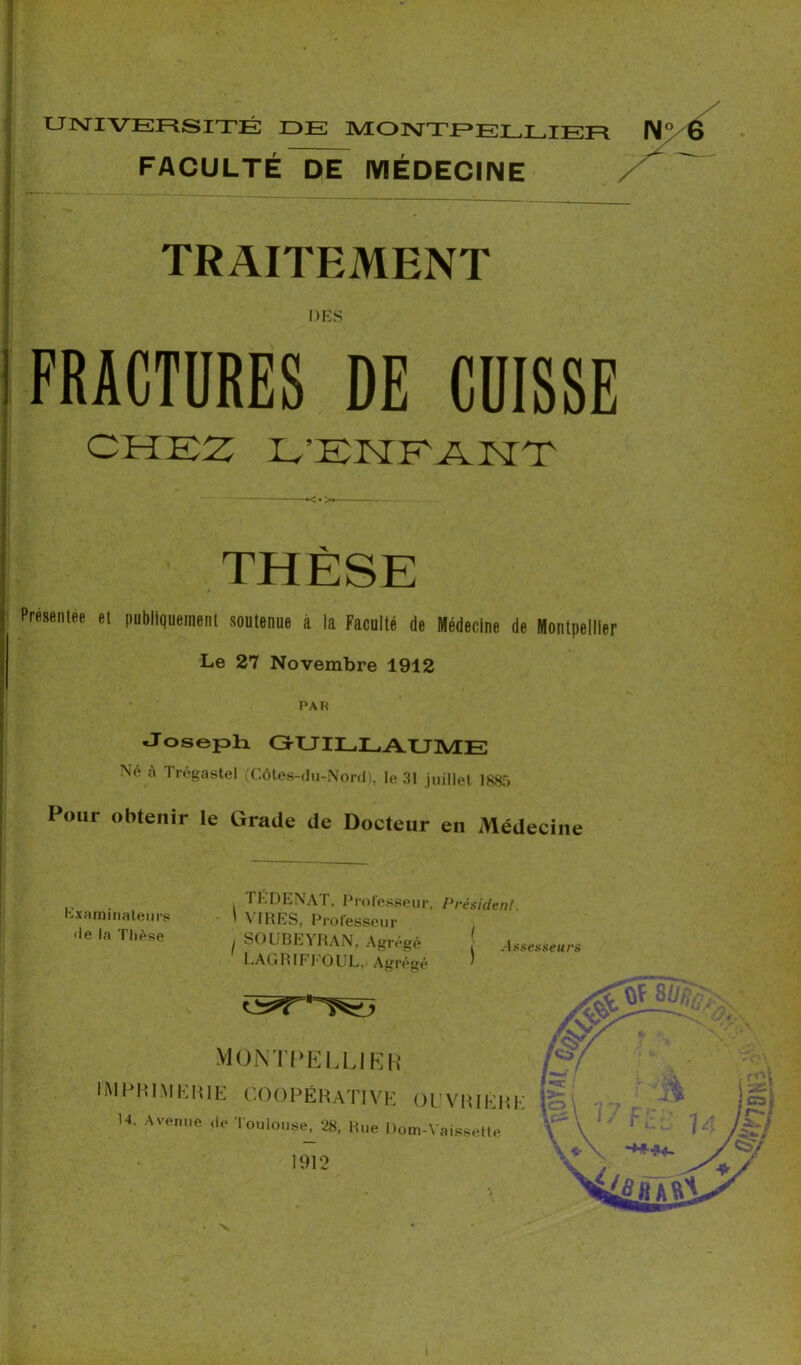 UNIVERSITÉ IDE MONTPELLIER FACULTÉ DE MÉDECINE / TRAITEMENT DES FRACTURES DE CUISSE CHEZ E’EHEAHT THÈSE PpéseiilM el imbllgueinenl sontenue à la Faculté de Médecine de Montpellier Le 27 Novembre 1912 PAR Joseph. GrUILLAUIVIE Né à Ti-égastel (Côles-du-Nord), le 31 juillet 1885 Pour obtenir le Grade de Docteur en Médecine 1 FI'.DLNAT, Pfote.'dseur, Président K.xfiinniatem-s i \'IRES, Professeur <ie la Thè.se SOUBEYRAN, Agrégé ! is LAGRIFEOUL, Agrégé ’ V
