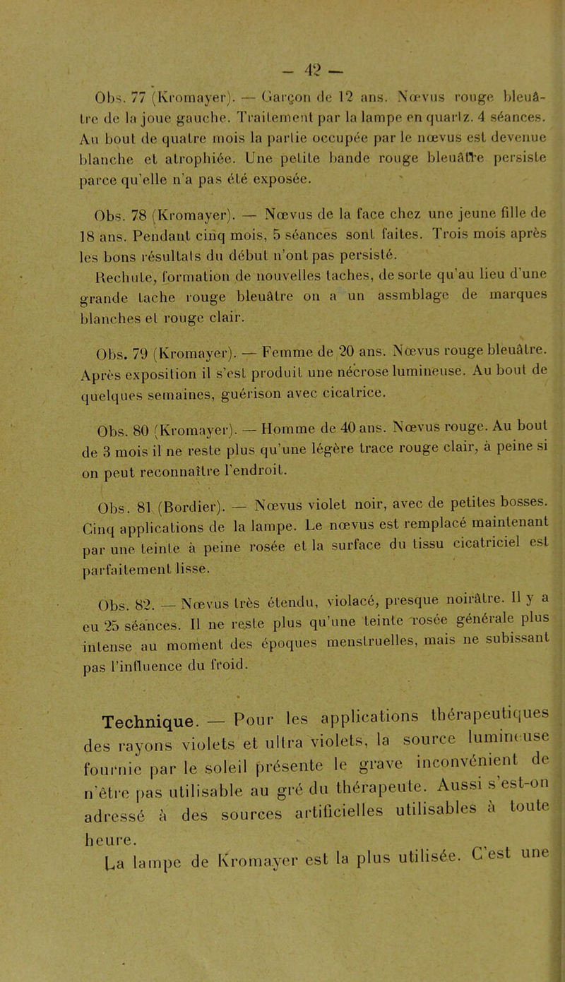 - 4‘> - Ohs. 77 (Kroinayer). — Garçon de 12 ans. Xœvns ronge hleuâ- Ire (le la jo\ie gauche. Traitement par la lampe en quartz. 4 séances. An bout de quatre mois la partie occupée par le nœvus est devenue blanche et atrophiée. Une petite bande rouge bleuAtTe persiste parce qu’elle n’a pas été exposée. Obs. 78 (Kroinayer). — Nœvus de la face chez une jeune fille de 18 ans. Pendant cinq mois, 5 séances sont faites. Trois mois après les bons résultats du début n’ont pas persisté. Rechute, formation de nouvelles taches, de sorte qu’au lieu d’une grande tache rouge bleuâtre on a un assmblage de marques blanches et rouge clair. Obs. 79 (Kromayer). — Femme de 20 ans. Nœvus rouge bleuâtre. Après exposition il s’csL produit une nécrose lumineuse. Au bout de quelques semaines, guérison avec cicatrice. Obs. 80 (Kromayer). — Homme de 40 ans. Nœvus rouge. Au bout de 3 mois il ne reste plus qu’une légère trace rouge clair, à peine si on peut reconnaître l’endroit. Obs. 81 (Bordier). — Nœvus violet noir, avec de petites bosses. Cinq applications de la lampe. Le nœvus est remplacé maintenant par une teinte à peine rosée et la surface du tissu cicatriciel est parfaitement lisse. Obs. 82. — Nœvus très étendu, violacé, presque noirâtre. 11 y a eu 25 séances. Il ne reste plus qu’une teinte rosée générale plus intense au moment des époques menstruelles, mais ne subissant pas l’influence du froid. Technique. — Pour les applications thérapeutiques des rayons violets et ultra violets, la soin ce luiniruuse fournie par le soleil présente le grave inconvénient de n'être pas utilisable au gré du thérapeute. Aussi s’est-on adressé îi des sources artificielles utilisables à toute heul’e. La lampe de Kromayer est la plus utilisée. C’est une