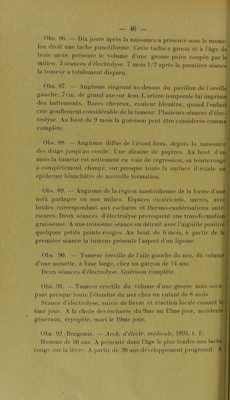 — — 01)s. 8(). Dix jours après la iiîiissancea présanlé sous le mame- lon droit une tache pimclirorme. Cette tache a grossi et à l’âge de trois mois présente le volume d’une grosse poire coupée parle milieu. 3 séances d électrolyse. 7 mois 1/2 après la première séance la tumeur a totalement disparu. Ohs. 87. — Angiome siégeant au-dessus du pavillon de l’oreille gauche, / cm. de grand axesur 4cm. L’artère temporale lui imprime des battements. Haros cheveux, couleur bleuâtre, quand l’enfant crie gontlement considérable de la tumeur. Plusieurs séances d’élec- trolyse. Au bout de 9 mois la guérison peut être considérée comme complète. Obs. 88. — Angiome ditTus de l’avant-bras, depuis la naissance des doigs jusqu'au coude. Une dizaine de piqâres. Aü bout d’un mois la tumeur est nettement en voie de régression, sa t<îinterouge a complètement changé, sur presque toute la surface il existe un épiderme blanchâtre de nouvelle formation. Obs. 89. — Angiome de la région mastoïdienne de la forme d’une ' noix partagée en son milieu. Espaces cicatriciels, nacrés, avec brides correspondant aux eschares et thermo-cautérisations anté- ; rieures. Deux séances d’électrolyse provoquent une transformation ' graisseuse. A une troisième séance on détruit avec l’aiguille positive quelques petits points rouges. Au bout de 6 mois, à partir de la première séance la tumeur présente l’aspect d’un lipome. i » ^ ^ \ Obs. 90. — Tumeur érectile de l’aile gauche du nez, du volume , d’une noisette, à base large, chez un garçon de 14 ans. Deux séances d’électrolyse. Guérison complète. Obs. 91. — Tumeur érectile du volume d’une grosse noix occu- pant presque toute l’étendue du nez chez un enfant de 8 mois. « Séance d’électrolyse, suivie de fièvre et réaction locale cessant le 6me jour. A la chute des eschares ylu 9me au 12me jour, accidents généraux, éry.«ipèle, mort le 19mejour. Obg. 92 (Bergonié. — Arch. d'éleclr. médicale, 1893, t. 1). Homme de 50 ans. A présenté dans l’âge le plus tendre une tache rouge sur la lèvre. A partir de 20 ans développement progressif. A