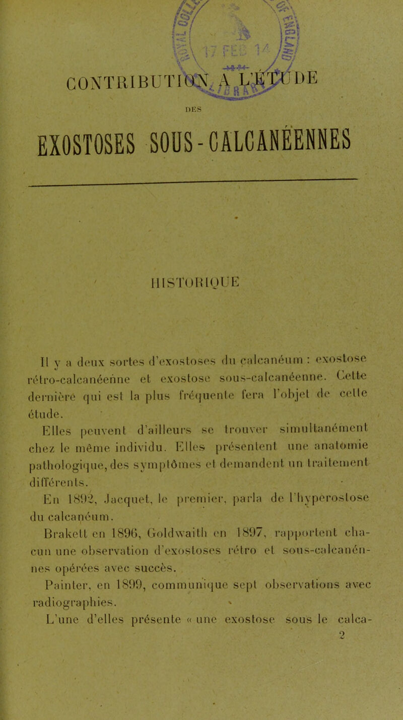 contiubuti0;:n\ a,k DES EXOSTOSES SOUS-CALCANEENNES lllSTUlUOlJE Il y a deux sortes d’exostoses du calcanéum : exostose rétro-calcaiîéenue et exostose soiis-calcanéenue. Celte dernière qui est la plus fré(juenle fera l'objet de celle étude. Elles peuvent d’ailleui's se li'ouver siinullaneinenl chez le même individu. Elle.s présentent une anatomie pathologique, des symptômes et demandent un traitement dilTérenls. En I8t)2, .lacquet, \c ju-emiei’, parla de l’hyperoslose du calcanéum. Bi'akell en 189G, Goldwaitli en 1897, i-apporlent cha- cun une observation d’exostoses rétro et sous-calcanén- nes opérées avec succès. Painler, en 1899, communicjue sept observations avec radiographies. ' L’une d’elles présente « une exostose sous le calca-