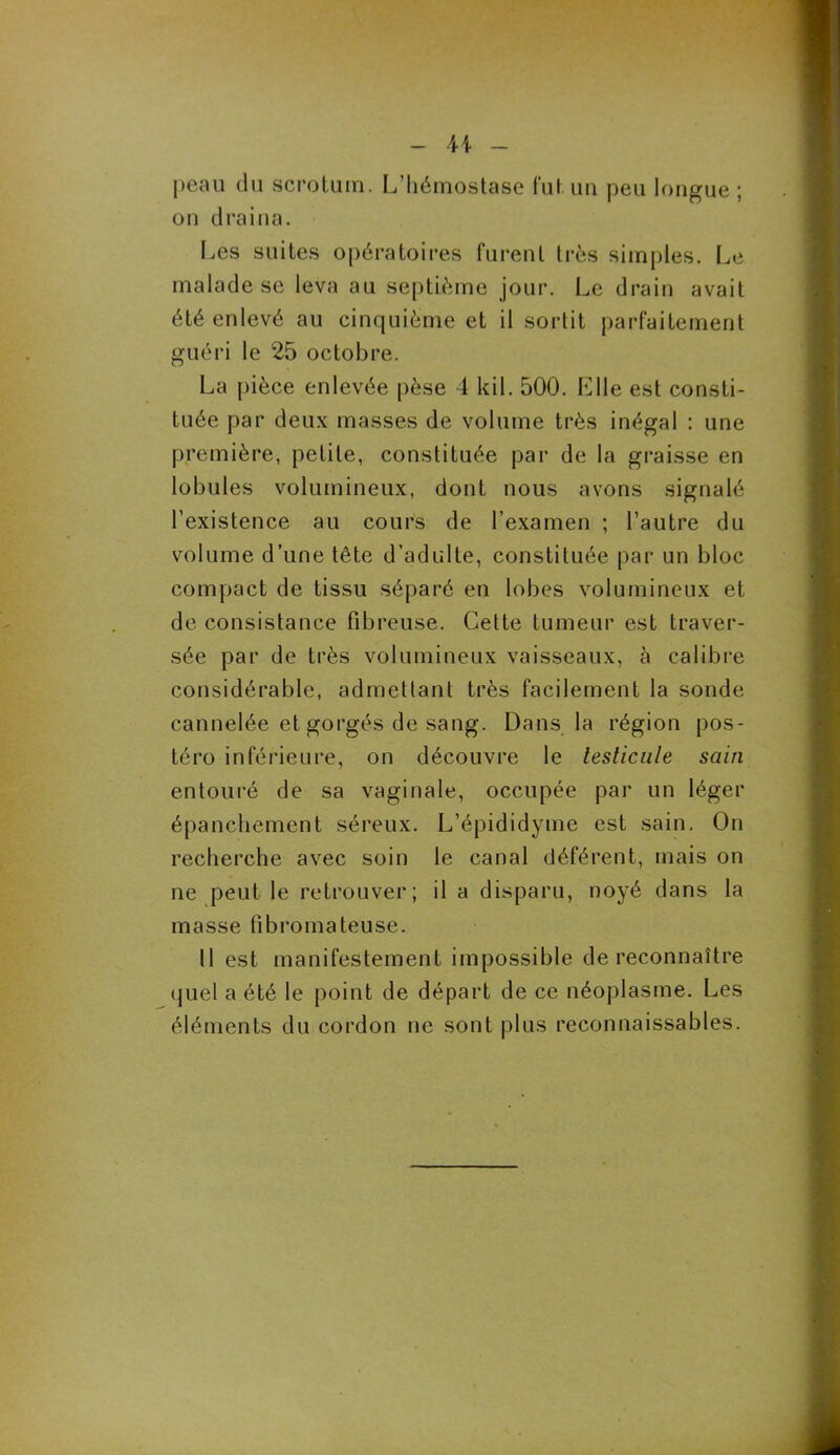 peau du scrotum. L’hémostase fut un peu longue ; on draina. Les suites opératoires furent très simples. Le malade se leva au septième jour. Le drain avait été enlevé au cinquième et il sortit parfaitement guéri le 25 octobre. La pièce enlevée pèse 4 kil. 500. Elle est consti- tuée par deux masses de volume très inégal : une première, petite, constituée par de la graisse en lobules volumineux, dont nous avons signalé l’existence au cours de l’examen ; l’autre du volume d’une tête d’adulte, constituée par un bloc compact de tissu séparé en lobes volumineux et de consistance fibreuse. Cette tumeur est traver- sée par de très volumineux vaisseaux, à calibre considérable, admettant très facilement la sonde cannelée et gorgés de sang. Dans la région pos- téro inférieure, on découvre le testicule sain entouré de sa vaginale, occupée par un léger épanchement séreux. L’épididyme est sain. On recherche avec soin le canal déférent, mais on ne peut le retrouver; il a disparu, noyé dans la masse fibromateuse. Il est manifestement impossible de reconnaître quel a été le point de départ de ce néoplasme. Les éléments du cordon ne sont plus reconnaissables.