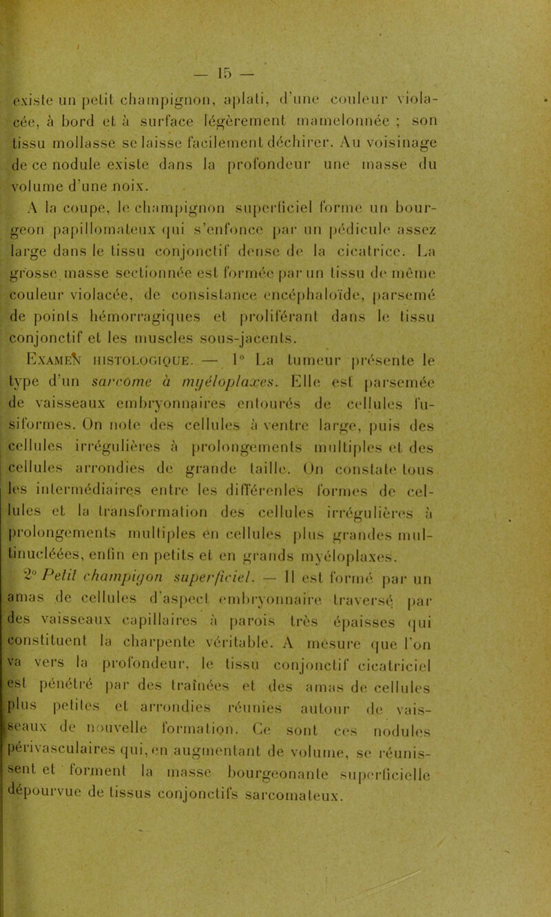 existe un petit champignon, aplati, d'une couleur viola- cée, à bord et à surface légèrement mamelonnée ; son tissu mollasse se laisse facilement déchirer. Au voisinage de ce nodule existe dans la profondeur une masse du volume d'une noix. A la coupe, le champignon superficiel forme un bour- geon papillomateux qui s’enfonce par un pédicule assez large dans le tissu conjonctif dense de la cicatrice. La grosse masse sectionnée est formée par un tissu de même couleur violacée, de consistance encéphaloïde, parsemé de points hémorragiques et proliférant dans le tissu conjonctif et les muscles sous-jacents. Examen histologique. — 1° La tumeur présente le type d’un sarcome à myéloplaxes. Elle est parsemée de vaisseaux embryonnaires entourés de cellules fu- siformes. On note des cellules à ventre large, puis des cellules irrégulières à prolongements multiples et des cellules arrondies de grande taille. On constate tous les intermédiaires entre les différentes formes de cel- lules et la transformation des cellules irrégulières à prolongements multiples en cellules plus grandes mul- tinucléées, enfin en petits et en grands myéloplaxes. 2° Petit champigon superficiel. — Il est formé par un amas de cellules d'aspect embryonnaire traversé par des vaisseaux capillaires à parois très épaisses qui constituent la charpente véritable. A mesure que I on va vers la profondeur, le tissu conjonctif cicatriciel esl pénétré par des traînées et des amas de cellules plus petites et arrondies réunies autour de vais- seaux de nouvelle formation. Ce sont ces nodules périvasculaires qui, en augmentant de volume, se réunis- sent et forment la masse bourgeonante superficielle dépourvue de tissus conjonctifs sarcomateux.