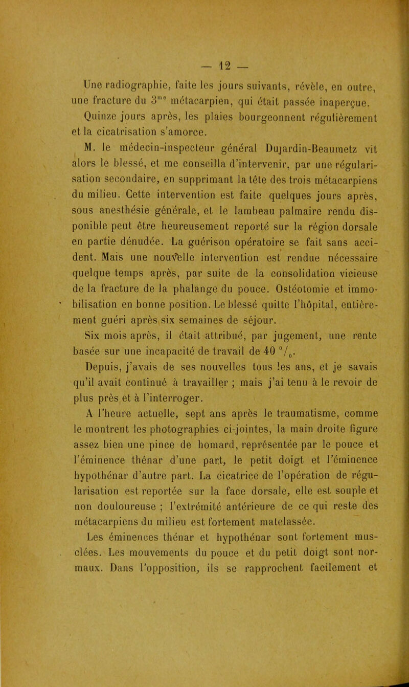 Une radiographie, faite les jours suivants, révèle, en outre, une fracture du 3mo métacarpien, qui était passée inaperçue. Quinze jours après, les plaies bourgeonnent régulièrement et la cicatrisation s’amorce. M. le médecin-inspecteur général Dujardin-Beaumetz vit alors le blessé, et me conseilla d’intervenir, par une régulari- sation secondaire, en supprimant la tête des trois métacarpiens du milieu. Cette intervention est faite quelques jours après, sous anesthésie générale, et le lambeau palmaire rendu dis- ponible peut être heureusement reporté sur la région dorsale en partie dénudée. La guérison opératoire se fait sans acci- * dent. Mais une nouvelle intervention est rendue nécessaire quelque temps après, par suite de la consolidation vicieuse de la fracture de la phalange du pouce. Ostéotomie et immo- bilisation en bonne position. Le blessé quitte l’hôpital, entière- ment guéri après six semaines de séjour. Six mois après, il était attribué, par jugement, une rente basée sur une incapacité de travail de 40 °/0. Depuis, j’avais de ses nouvelles tous les ans, et je savais qu’il avait continué à travailler ; mais j’ai tenu à le revoir de plus près et à l’interroger. A l’heure actuelle, sept ans après le traumatisme, comme le montrent les photographies ci-jointes, la main droite figure assez bien une pince de homard, représentée par le pouce et l’éminence thénar d’une part, le petit doigt et l’éminence hypothénar d’autre part. La cicatrice de l’opération de régu- larisation est reportée sur la face dorsale, elle est souple et non douloureuse ; l’extrémité antérieure de ce qui reste des métacarpiens du milieu est fortement matelassée. Les éminences thénar et hypothénar sont fortement mus- clées. Les mouvements du pouce et du petit doigt sont nor- maux. Dans l’opposition, ils se rapprochent facilement et