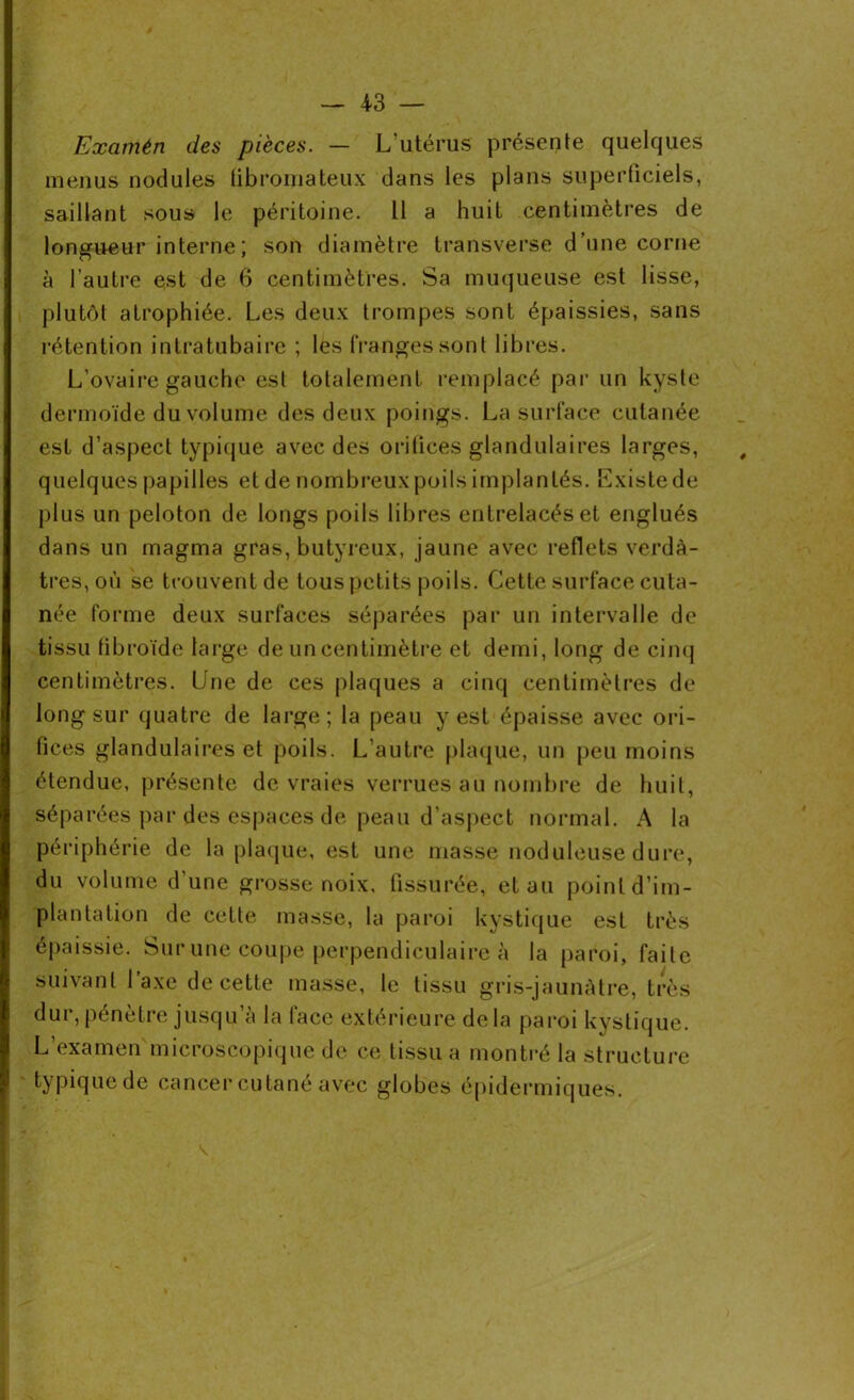 Examèn des pièces. — L'utérus présente quelques menus nodules fibromateux dans les plans superficiels, saillant sous le péritoine. Il a huit centimètres de longueur interne ; son diamètre transverse d’une corne à l’autre est de 6 centimètres. Sa muqueuse est lisse, plutôt atrophiée. Les deux trompes sont épaissies, sans rétention intratubaire ; les franges sont libres. L’ovaire gauche est totalement remplacé par un kyste dermoïde du volume des deux poings. La surface cutanée est d’aspect typique avec des orifices glandulaires larges, quelques papilles et de nombreux poils implantés. Existe de plus un peloton de longs poils libres entrelacés et englués dans un magma gras, butyreux, jaune avec reflets verdâ- tres, où se trouvent de tous petits poils. Cette surface cuta- née forme deux surfaces séparées par un intervalle de tissu tibroïde large de un centimètre et demi, long de cinq centimètres. Une de ces plaques a cinq centimètres de long sur quatre de large; la peau y est épaisse avec ori- fices glandulaires et poils. L’autre plaque, un peu moins étendue, présente de vraies verrues au nombre de huit, séparées par des espaces de peau d’aspect normal. A la périphérie de la plaque, est une masse noduleuse dure, du volume d’une grosse noix, fissurée, et au point d’im- plantation de cette masse, la paroi kystique est très épaissie. Sur une coupe perpendiculaire à la paroi, faite suivant l’axe de cette masse, le tissu gris-jaunâtre, très dur, pénètre jusqu’à la face extérieure delà paroi kystique. L’examen microscopique de ce tissu a montré la structure typiquede cancer cutané avec globes épidermiques. #