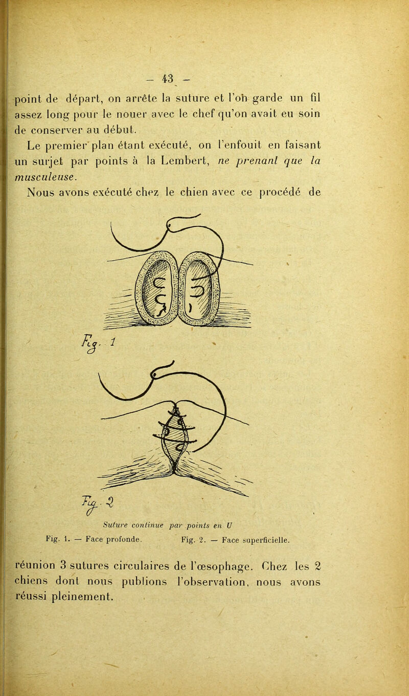point de départ, on arrête la suture et l’oh garde un fil assez long pour le nouer avec le chef qu’on avait eu soin de conserver au début. Le premier'plan étant exécuté, on l’enfouit en faisant un surjet par points à la Lembert, ne prenant que la musculeuse. Nous avons exécuté chez le chien avec ce procédé de Suture continue par points en U Fig- 1. — Face profonde. Fig. 2. — Face superficielle. réunion 3 sutures circulaires de l’oesophage. Chez les 2 chiens dont nous publions l’observation, nous avons réussi pleinement.