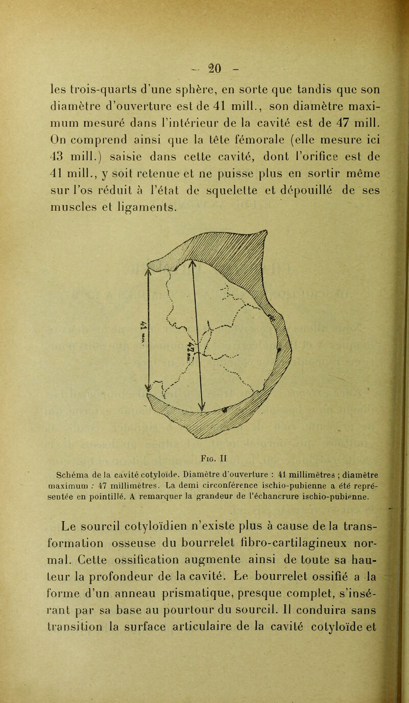 les trois-quarts d’une sphère, eu sorte que tandis que son diamètre d’ouverture est de 41 mill., son diamètre maxi- mum mesuré dans l’intérieur de la cavité est de 47 mill. On comprend ainsi que la tête fémorale (elle mesure ici 43 mill.) saisie dans cette cavité, dont l’orifice est de 41 mill., y soit retenue et ne puisse plus en sortir même sur l’os réduit à l’état de squelette et dépouillé de ses muscles et ligaments. Fig. II Schéma de la cavité cotyloide. Diamètre d'ouverture : 41 millimètres ; diamètre maximum : 47 millimètres. La demi circonférence ischio-pubienne a été repré- sentée en pointillé. A remarquer la grandeur de l’échancrure ischio-pubienne. Le sourcil cotyloïdien n’existe plus à cause delà trans- formation osseuse du bourrelet fibro-cartilagineux nor- mal. Cette ossification augmente ainsi de toute sa hau- teur la profondeur de la cavité. Le bourrelet ossifié a la forme d’un anneau prismatique, presque complet, s’insé- rant par sa base au pourtour du sourcil. Il conduira sans transition la surface articulaire de la cavité cotyloide et