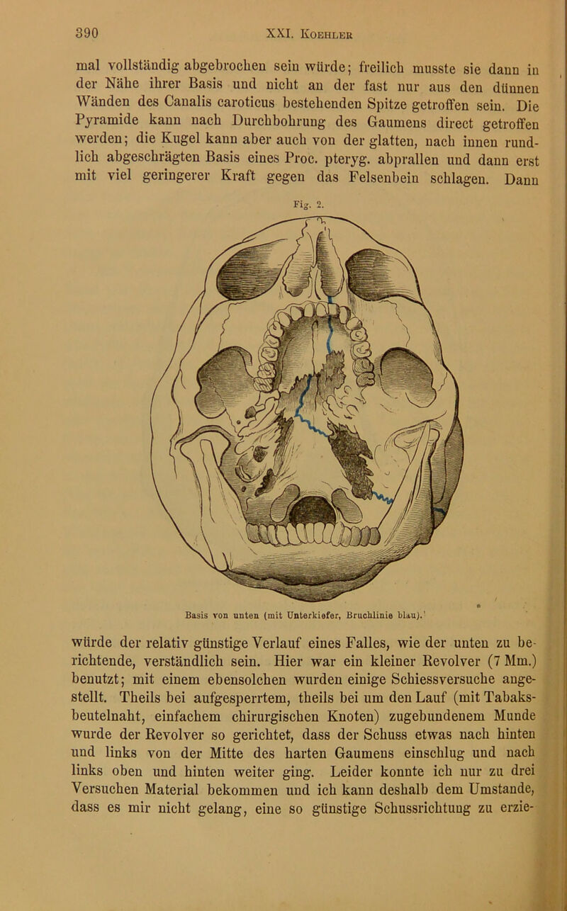 mal vollständig abgebrochen sein würde; freilich musste sie daun in der Nähe ihrer Basis und nicht an der fast nur aus den dünnen Wänden des Canalis caroticus bestehenden Spitze getroffen sein. Die Pyramide kann nach Durchbohrung des Gaumens direct getroffen werden; die Kugel kann aber auch von der glatten, nach innen rund- lich abgeschrägten Basis eines Proc. pteryg. abprallen und dann erst mit viel geringerer Kraft gegen das Felsenbein schlagen. Dann Fig. 2. Basis von unten (mit Unterkiefer, Bruoiilinie blau).’ würde der relativ günstige Verlauf eines Falles, wie der unten zu be- richtende, verständlich sein. Hier war ein kleiner Revolver (7 Mm.) benutzt; mit einem ebensolchen wurden einige Schiessversuche ange- stellt. Theils bei aufgesperrtem, theils bei um den Lauf (mit Tabaks- beutelnaht, einfachem chirurgischen Knoten) zugebundenem Munde wurde der Revolver so gerichtet, dass der Schuss etwas nach hinten und links von der Mitte des harten Gaumens einschlug und nach links oben und hinten weiter ging. Leider konnte ich nur zu drei Versuchen Material bekommen und ich kann deshalb dem Umstande, dass es mir nicht gelang, eine so günstige Schussrichtung zu erzie-