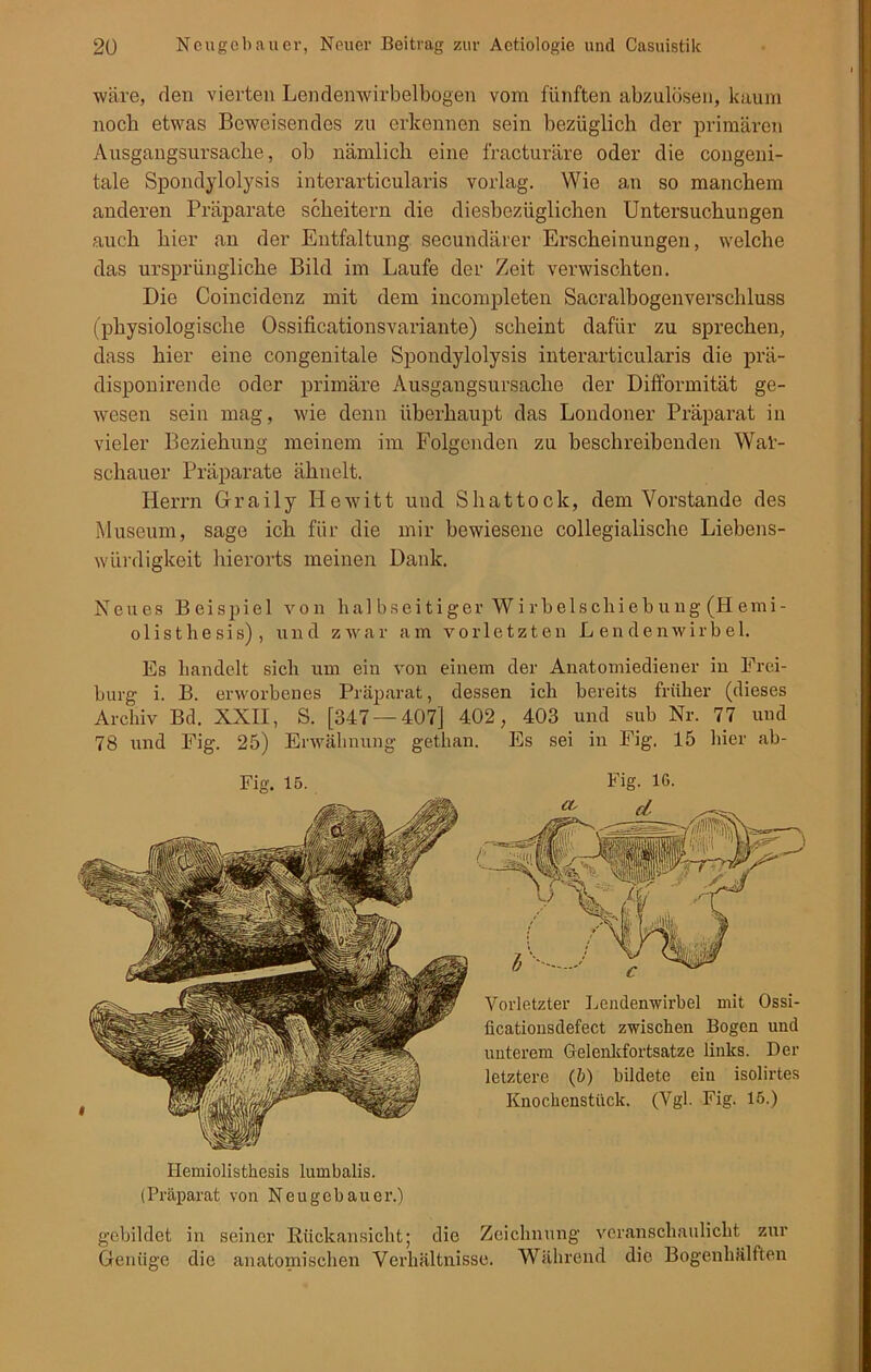 wäre, den vierten Lendenwirbelbogen vom fünften abzulösen, kaum noch etwas Beweisendes zu erkennen sein bezüglich der primären Ausgangsursache, ob nämlich eine fracturäre oder die congeni- tale Spondylolysis interarticularis vorlag. Wie an so manchem anderen Präparate scheitern die diesbezüglichen Untersuchungen auch hier an der Entfaltung secundärer Erscheinungen, welche das ursprüngliche Bild im Laufe der Zeit verwischten. Die Coincidenz mit dem iucompleten Sacralbogenverschluss (physiologische Ossificationsvariante) scheint dafür zu sprechen, dass hier eine congenitale Spondylolysis interarticularis die prä- disponirende oder primäre Ausgangsursache der Difformität ge- wesen sein mag, wie denn überhaupt das Londoner Präparat in vieler Beziehung meinem im Folgenden zu beschreibenden Wal- schauer Präparate ähnelt. Herrn Graily Hewitt und Shattock, dem Vorstande des Museum, sage ich für die mir bewiesene collegialische Liebens- würdigkeit hierorts meinen Dank. Neues Beispiel von halbseitiger Wi rbe 1 scliieb u ng (H emi- olist hesis), und zwar am vorletzten Lendenwirbel. Es handelt sich um ein von einem der Anatomiediener in Frei- burg i. B. erworbenes Präparat, dessen ich bereits früher (dieses Archiv Bd. XXII, S. [347 — 407] 402, 403 und sub Nr. 77 und 78 und Fig. 25) Erwähnung gethan. Es sei in Fig. 15 hier ab- Fig. 15. Fig. IG. Vorletzter Lendenwirbel mit Ossi- ficationsdefect zwischen Bogen und unterem Gelenkfortsatze links. Der letztere (b) bildete ein isolirtes Knochenstück. (Vgl. Fig. 15.) Hemiolisthesis lumbalis. (Präparat von Neugebauer.) gebildet in seiner Rückansicht; die Zeichnung veranschaulicht zur Genüge die anatomischen Verhältnisse. Während die Bogenhälften