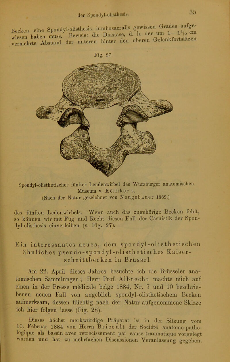 Becken eine Sponclyl-olisthesis lumbosacralis gewissen Grades aufge- wiesen haben muss/ Beweis: die Diastase, d. ^^7^2 vermehrte Abstand der unteren hinter den oberen Gelenk(oitsatzen Fis. 27. Spondyl-olisthetischer fünfter Lendenwirbel des Würzburger anatomischen Museum v. Kolliker’s. (Nach der Natur gezeichnet von Neugebauer 1882.) des fünften Ledenwirbels. Wenn auch das zugehörige Becken fehlt, so können wir mit Fug und Recht diesen Fall der Casuistik der Spon- dyl-olisthesis einverleiben (s. Fig. 27). Ein interessantes neues, dem spondyl-olisthetischen ähnliches pseudo-spondyl-olisthetisches Kaiser- schnittbecken in Brüssel. Am 22. April dieses Jahres besuchte ich die Brüsseler ana- tomischen Sammlungen; Herr Prof. Alb recht machte mich auf einen in der Presse medicale beige 1884, Nr. 7 und 10 beschrie- benen neuen Fall von angeblich spondyl-olisthetischem Becken aufmerksam, dessen flüchtig nach der Natur aufgenommene Skizze ich hier folgen lasse (Fig. 28). Dieses höchst merkwürdige Präparat ist in der Sitzung vom 10. Februar 1884 von Herrn Bricoult der Sociötd anatomo-patho- logicpie als bassin avec retrecissement par cause träum atique vorgelegt worden und hat zu mehrfachen Discussionen Veranlassung gegeben.