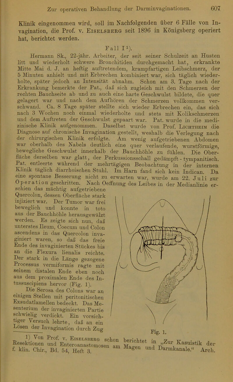 Klinik eingenommen wird, soll im Nachfolgenden über 6 Fälle von In- vagination, die Prof. v. Eiselsberg seit 1896 in Königsberg operiert hat, berichtet werden. Hermann Sk., 22-jähr. Arbeiter, der seit seiner Schulzeit an Husten Mitte Mai d. J. an heftig auftretendem, krampfartigen Leibschmerz, der 5 Minuten anhielt und mit Erbrechen kombiniert war, sich täglich wieder- holte, später jedoch an Intensität abnahm. Schon am 3. Tage nach der Erkrankung bemerkte der Pat., daß sich zugleich mit den Schmerzen der rechten Bauchseite ab und zu auch eine harte Geschwulst bildete, die quer gelagert war und nach dem Aufhören der Schmerzen vollkommen ver- schwand. Ca. 8 Tage später stellte sich wieder Erbrechen ein, das sich nach 3 Wochen noch einmal wiederholte und stets mit Kolikschmerzen und dem Auftreten der Geschwulst gepaart war. Pat. wurde in die medi- zinische Klinik aufgenommen. Daselbst wurde von Prof. Lichtheim die Diagnose auf chronische Invagination gestellt, weshalb die Verlegung nach der chirurgischen Klinik erfolgte. Am wenig aufgetriebenen Abdomen wai oberhalb des Nabels deutlich eine quer verlaufende, wurstförmige, bewegliche Geschwulst innerhalb der Bauchhöhle zu fühlen. Die Ober- fläche derselben war glatt, der Perkussionsschall gedämpft - tympanitisch. Pat, entleerte während der mehrtägigen Beobachtung in der internen Klinik täglich diarrhoischen Stuhl. Im Harn fand sich kein Indican. Da eine spontane Besserung nicht zu erwarten war, wurde am 22. Juli zur Operation geschritten. Nach Oeffnung des Leibes in der Medianlinie er- schien das mächtig aufgetriebene Quercolon, dessen Oberfläche stark injiziert war. Der Tumor war frei beweglich und konnte in toto aus der Bauchhöhle herausgewälzt werden. Es zeigte sich nun, daß unterstes Ileum, Coecum und Colon Die Serosa des Colons war an einigen Stellen mit peritonitischen Exsudatlamellen bedeckt. Das Me- senterium der invaginierten Partie schwielig verdickt. Ein vorsich- 1 tiger Versuch lehrte, daß an ein Lösen der Invagination durch Zug Fall I1). litt imd wiederholt schwere Bronchitiden durchgemacht hat, erkrankte seinem distalen Ende eben noch aus dem proximalen Ende des In- tussuscipiens hervor (Fig. 1). Processus vermiformis ragte mit ascendens in das Quercolon inva- giniert waren, so daß das freie Ende des invaginierten Stückes bis an die Elexura lienalis reichte. Der stark in die Länge gezogene 1) Von Prof. v. Eiselsberc Resektionen und Enteroanastom f. klin. Chir., Bd. 54, Heft 3.