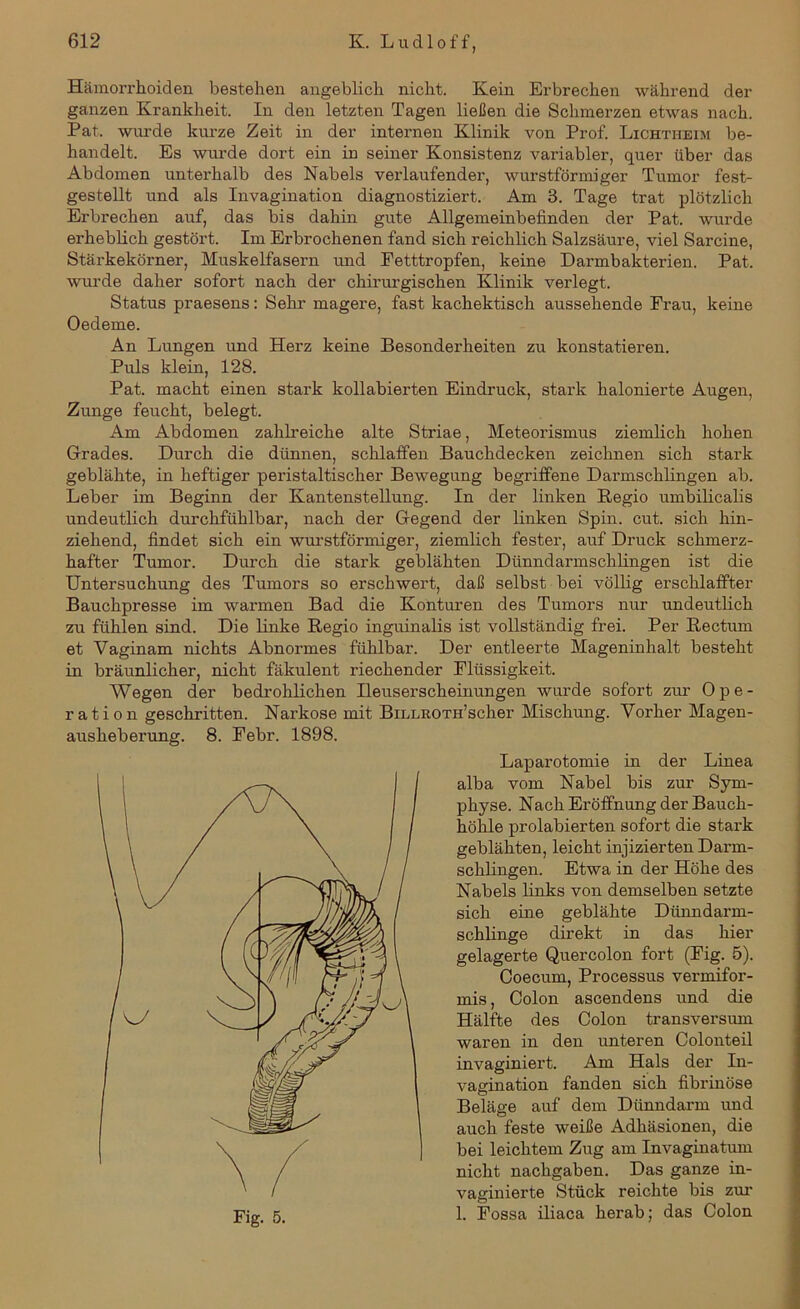 Hämorrhoiden bestehen angeblich nicht. Kein Erbrechen während der ganzen Krankheit. In den letzten Tagen ließen die Schmerzen etwas nach. Pat. wurde kurze Zeit in der internen Klinik von Prof. Lichtheim be- handelt. Es wurde dort ein in seiner Konsistenz variabler, quer über das Abdomen unterhalb des Nabels verlaufender, wurstförmiger Tumor fest- gestellt und als Invagination diagnostiziert. Am 3. Tage trat plötzlich Erbrechen auf, das bis dahin gute Allgemeinbefinden der Pat. wurde erheblich gestört. Im Erbrochenen fand sich reichlich Salzsäure, viel Sarcine, Stärkekörner, Muskelfasern und Eetttropfen, keine Darmbakterien. Pat. wurde daher sofort nach der chirurgischen Klinik verlegt. Status praesens: Sehr magere, fast kachektisch aussehende Frau, keine Oedeme. An Lungen und Herz keine Besonderheiten zu konstatieren. Puls klein, 128. Pat. macht einen stark kollabierten Eindruck, stark kalonierte Augen, Zunge feucht, belegt. Am Abdomen zahlreiche alte Striae, Meteorismus ziemlich hohen Grades. Durch die dünnen, schlaffen Bauchdecken zeichnen sich stark geblähte, in heftiger peristaltischer Bewegung begriffene Darmschlingen ab. Leber im Beginn der Kantenstellung. In der linken Regio umbilicalis undeutlich durchfühlbar, nach der Gegend der linken Spin. cut. sich hin- ziehend, findet sich ein wurstförmiger, ziemlich fester, auf Druck schmerz- hafter Tumor. Durch die stark geblähten Dünndarmschlingen ist die Untersuchung des Tumors so erschwert, daß selbst bei völlig erschlaffter Bauchpresse im warmen Bad die Konturen des Tumors nur undeutlich zu fühlen sind. Die linke Regio inguinalis ist vollständig frei. Per Rectum et Vaginam nichts Abnormes fühlbar. Der entleerte Mageninhalt besteht in bräunlicher, nicht fäkulent riechender Flüssigkeit. Wegen der bedrohlichen Ileuserscheinungen wurde sofort zur Ope- ration geschritten. Narkose mit BiLLROTH’scher Mischung. Vorher Magen- ausheberung. 8. Febr. 1898. Laparotomie in der Linea alba vom Nabel bis zur Sym- physe. Nach Eröffnung der Bauch- höhle prolabierten sofort die stark geblähten, leicht injizierten Darm- schlingen. Etwa in der Höhe des Nabels links von demselben setzte sich eine geblähte Dünndarm- schlinge direkt in das hier gelagerte Quercolon fort (Fig. 5). Coecum, Processus vermifor- mis , Colon ascendens und die Hälfte des Colon transversum waren in den unteren Colonteil invaginiert. Am Hals der In- vagination fanden sich fibrinöse Beläge auf dem Dünndarm und auch feste weiße Adhäsionen, die bei leichtem Zug am Invaginatum nicht nachgaben. Das ganze in- vaginierte Stück reichte bis zur 1. Fossa iliaca herab; das Colon