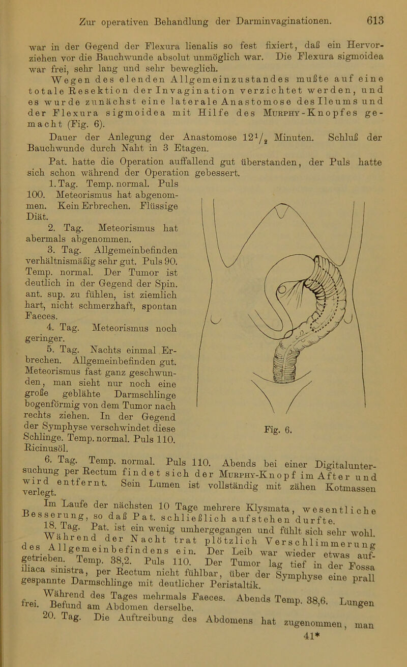 war in der Gegend der Flexura lienalis so fest fixiert, daß ein Hervor- ziehen vor die Bauchwunde absolut unmöglich war. Die Flexura sigmoidea war frei, sehr lang und sehr beweglich. Wegen des elenden Allgemeinzustandes mußte auf eine totale Resektion der Invagination verzichtet werden, und es wurde zunächst eine laterale Anastomose deslleums und der Flexura sigmoidea mit Hilfe des Murphy - K n o p f e s ge- macht (Fig. 6). Dauer der Anlegung der Anastomose 121/2 Minuten. Schluß der Bauchwunde durch Naht in 3 Etagen. Pat. hatte die Operation auffallend gut überstanden, der Puls hatte sich schon während der Operation 1. Tag. Temp. normal. Puls 100. Meteorismus hat abgenom- men. Kein Erbrechen. Flüssige Diät. 2. Tag. Meteorismus hat abermals abgenommen. 3. Tag. Allgemeinbefinden verhältnismäßig sehr gut. Puls 90. Temp. normal. Der Tumor ist deutlich in der Gegend der Spin, ant. sup. zu fühlen, ist ziemlich hart, nicht schmerzhaft, spontan Faeces. 4. Tag. Meteorismus noch geringer. 5. Tag. Nachts einmal Er- brechen. Allgemeinbefinden gut. Meteorismus fast ganz geschwun- den , man sieht nur noch eine große geblähte Darmschlinge bogenförmig von dem Tumor nach rechts ziehen. In der Gegend der Symphyse verschwindet diese Schlinge. Temp. normal. Puls 110. Ricinus öl. gebessert. 6. Tag. Temp. normal. Puls 110. Abends bei einer Digitalunter- suc ung per Rectum findet sich der MuRPHY-Ivnopf im After und verlegtentfernt' ^ Lumen ist vollständig mit zähei1 Kotmassen Im Laufe der nächsten 10 Tage mehrere Klysmata, wesentliche Besserung, so daß Pat. schließlich aufstehen durfte. w -iS' i l 1St ®in wenig umhergegangen und fühlt sich sehr wohl Wahreuü der Nacht trat plötzlich Verschlimmerung des AUgemenibefmcl ens ein. Der Leib war wieder etwas auf getneben. Temp. 38,2. Pule 110. Der Teurer lag tief in der Poet haca smistra, per Rectum nicht fühlbar, über der Symphvse eine nm fl gespannte Darmschlinge mit deutlicher Peristaltik. P Wahrend des Tages mehrmals Faeces. Abends Ten-m u« ß t frei. Befund am Abdomen derselbe. P' 38’6< Luugen 20. Tag. Die Auftreibung des Abdomens hat zugenommen, man 41*