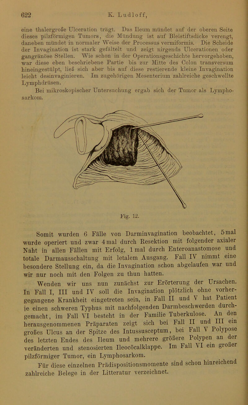 eine thalergroße Ulcerafcion trägt. Das Ileum mündet auf der oberen Seite dieses pilzförmigen Tumors, die Mündung ist auf Bleistiftsdicke verengt, daneben mündet in normaler Weise der Processus vermiformis. Die Scheide der Invagination ist stai'k gefältelt und zeigt nirgends Ulcerationen oder gangränöse Stellen. Wie schon in der Operationsgeschichte hervorgehoben, war diese eben beschriebene Partie bis zur Mitte des Colon transversum hineingestülpt, ließ sich aber bis auf diese restierende kleine Invagination leicht desinvaginieren. Im zugehörigen Mesenterium zahlreiche geschwellte Lymphdriisen. Bei mikroskopischer Untersuchung ergab sich der Tumor als Lympho- sarkom. Somit wurden 6 Fälle von Darminvagination beobachtet, 5mal wurde operiert und zwar 4 mal durch Resektion mit folgender axialer Naht in allen Fällen mit Erfolg, 1 mal durch Enteroanastomose und totale Darmausschaltung mit letalem Ausgang. Fall IV nimmt eine besondere Stellung ein, da die Invagination schon abgelaufen war und wir nur noch mit den Folgen zu thun hatten. Wenden wir uns nun zunächst zur Erörterung der Ursachen. In Fall I, III und IV soll die Invagination plötzlich ohne vorher- gegangene Krankheit ein getreten sein, in Fall II und V hat Patient ie einen schweren Typhus mit nachfolgenden Darmbeschweiden duich- gemacht, im Fall VI besteht in der Familie Tuberkulose. An den herausgenommenen Präparaten zeigt sich bei Fall II und III ein großes Ulcus an der Spitze des Intussusceptum, bei Fall V Polypose des letzten Endes des Ileum und mehrere größere Polypen an der veränderten und stenosierten Ueocöcalklappe. Im Fall VI ein großer pilzförmiger Tumor, ein Lymphosarkom. Für diese einzelnen Prädispositionsmomente sind schon hinreichend zahlreiche Belege in der Litteratur verzeichnet.