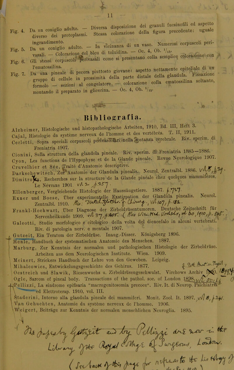 Fig. 4. Fig. Fig. 6. Fig. • r artnlto — Diversa disposizione dei granuli fucsinofili ed aspetto pr“^. Stessa colorazione della «gora precedente: aguale r^TtSio adulto. - In vicinanza di „n vaso Nanrc,osi corpuacoli peri- ,. Pninvo'/ìntip eoi bleu di toluidina. — De. 4, '~'u- /ìs- Gli* stéssi corpuscoli' trerivasali co,ne si presentano colla scapile, coloracene con “ :■ri; rssrxs.=irsrtr So - sezioni a! congelatore - colorazione eolia ematossrhna soltanto, montando il preparato in glicerina. — Oc. 4, Ob. Vis- Bibliografia. Alzheimer, Histologische und histopathologische Arbeiten, 1910, Bd. IH, Heft 3. Caial Histologie dn système nerveux de l’homme et des vertebres. 1. 1 > . Cerletti, Sopra speciali corpuscoli perivascòlàri nella 'sostanza cerebrale. Eiv. spenni. ì Cionini, Sulla struttura della glandola pineale. Riv. sperim. dr Freniatria l88o-lS86. Cyon, Les functions de rHypophyse et de la Glande pineale. Revue Neurologique 190r. Cruvelliier et Sée, limitò d’Anatomie descriptive “r v i 1 • X 1, r7.,„ A nnf/xrviln rlnr manchila nini Neurol. Cruvelliier et Sée, Iraite d Anatomie aescnpuve. /» «r Darkschewitsch, Zur Anatomie der Gianduia pinealis. Neurol. Zentralbl. 1886. V' Dimitro'Jfca, Recherches sur la structure de la Glande pinéale chez quelques mammiferes. Le Névraxe 1901 vA 3- • Ellenberger, Vergleichende Histologie der Haussaugetiere. 1887. Exner und Boese, tìber experimentelle. Exstinmtion der Gianduia pinealis. Zentralbl. 1910. Mis : C4iA“Y -( vA IcTJ, Frankl-Hochwart, tìber Diagnose der Zirbeldriisentumoren. Deutsche Zeitsclmft fur - Nervenheilkunde 1909. ( fa* ff-. Galeotti, Studio morfologico e citologico della volta del diencefalo in alcuni vertebrati. Riv. di patologia nerv. e mentale 1907. Gutzeit, Ein Teratom der Zirbeldriise. Inaug.-Disser. Konigsberg 1896. Henìe, Handbuch der systematischen Anatomie des Menschen. 1887. Marburg, Zur Kenntnis der normalen und pathologischen Histologie der Zirbeldriise. Arbeiten aus dem Neurologischen Instituto. Wien. 1909. Mcinert, Strickers Handbuch der Lehre von den Gewehen. Leipzig. . Mihalcowics, Entwickelungsgeschichte des Gehirns. 1877. > Oestreich und Slawik, Riesenwuchs u. Zirbeldriisengeschwulst. Virchows Archiv f^p. n ’  il——,T-J- A 0 Oglc, Sarcoin of pineal body. Transactions of thè pathol. soc. of London 189R,S~Pj t fa -LlPellizzi, La sindrome epifisaria “macrogenitosomia precoce11. Riv. It. di Neurop/Psickiama-' ed Elettroterap. 1910, voi. III. Staderini, Intorno alla gianduia pineale dei mammiferi. Monit. Zool. It. 1897. \f{\ 8f ■ \ Van Gehuchtcn, Anatomie du système nerveux de l’homme. 1906. \W\eii 1895.