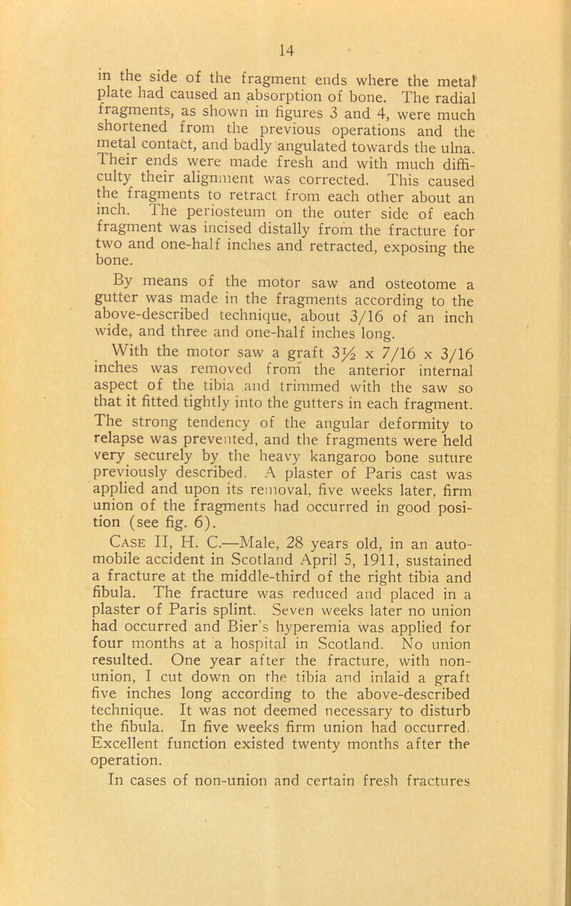 in the side of the fragment ends where the metal plate had caused an absorption of bone. The radial fragments, as shown in figures 3 and 4, were much shortened from the previous operations and the metal contact, and badly angulated towards the ulna. Their ends were made fresh and with much diffi- culty their alignment was corrected. This caused the fragments to retract from each other about an inch. Ihe periosteum on the outer side of each fragment was incised distally from the fracture for two and one-half inches and retracted, exposing the bone. By means of the motor saw and osteotome a gutter was made in the fragments according to the above-described technique, about 3/16 of an inch wide, and three and one-half inches long. With the motor saw a graft 3y2 x 7/16 x 3/16 inches was removed from the anterior internal aspect of the tibia and trimmed with the saw so that it fitted tightly into the gutters in each fragment. The strong tendency of the angular deformity to relapse was prevented, and the fragments were held very securely by the heavy kangaroo bone suture previously described. A plaster of Paris cast was applied and upon its removal, five weeks later, firm union of the fragments had occurred in good posi- tion (see fig. 6). Case II, H. C.—Male, 28 years old, in an auto- mobile accident in Scotland April 5, 1911, sustained a fracture at the middle-third of the right tibia and fibula. The fracture was reduced and placed in a plaster of Paris splint. Seven weeks later no union had occurred and Bier’s hyperemia was applied for four months at a hospital in Scotland. No union resulted. One year after the fracture, with non- union, I cut down on the tibia and inlaid a graft five inches long according to the above-described technique. It was not deemed necessary to disturb the fibula. In five weeks firm union had occurred. Excellent function existed twenty months after the operation. In cases of non-union and certain fresh fractures