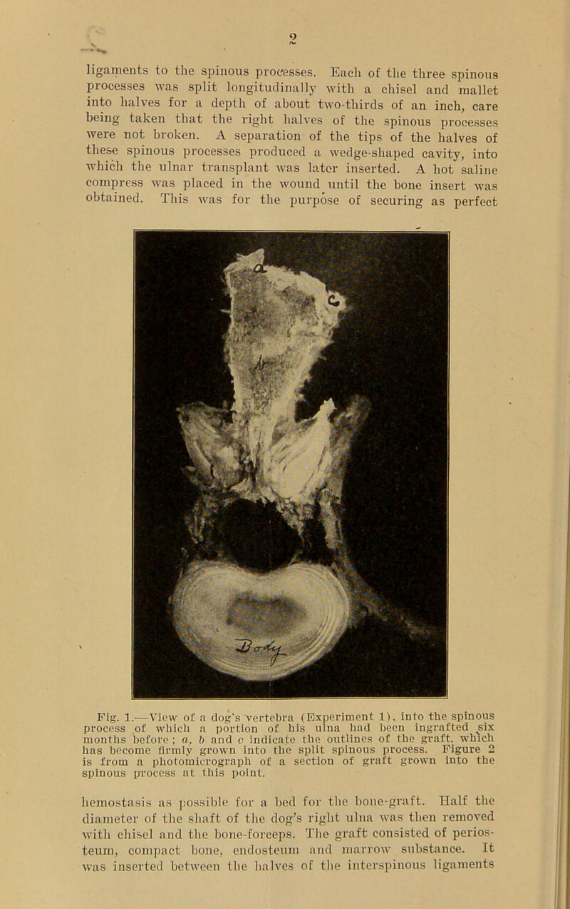 ligaments to the spinous processes, Each of the three spinous processes was split longitudinally with a chisel and mallet into halves for a depth of about two-thirds of an inch, care being taken that the right halves of the spinous processes were not broken. A separation of the tips of the halves of these spinous processes produced a wedge-shaped cavity, into which the ulnar transplant was later inserted. A hot saline compress was placed in the wound until the bone insert was obtained. This was for the purpose of securing as perfect Fig. 1.—View of a dog's vertebra (Experiment 1), into the spinous process of which a portion of his ulna had been ingrafted six months before ; a. b and c indicate the outlines of the graft, which has become firmly grown into the split spinous process. Figure 2 is from a photomicrograph of a section of graft grown into the spinous process at this point. hemostasis as possible for a bed for the bone-graft. Half the diameter of the shaft of the dog’s right ulna was then removed with chisel and the bone-forceps. The graft consisted of perios- teum, compact bone, endosteum and marrow substance. It was inserted between the halves of the interspinous ligaments