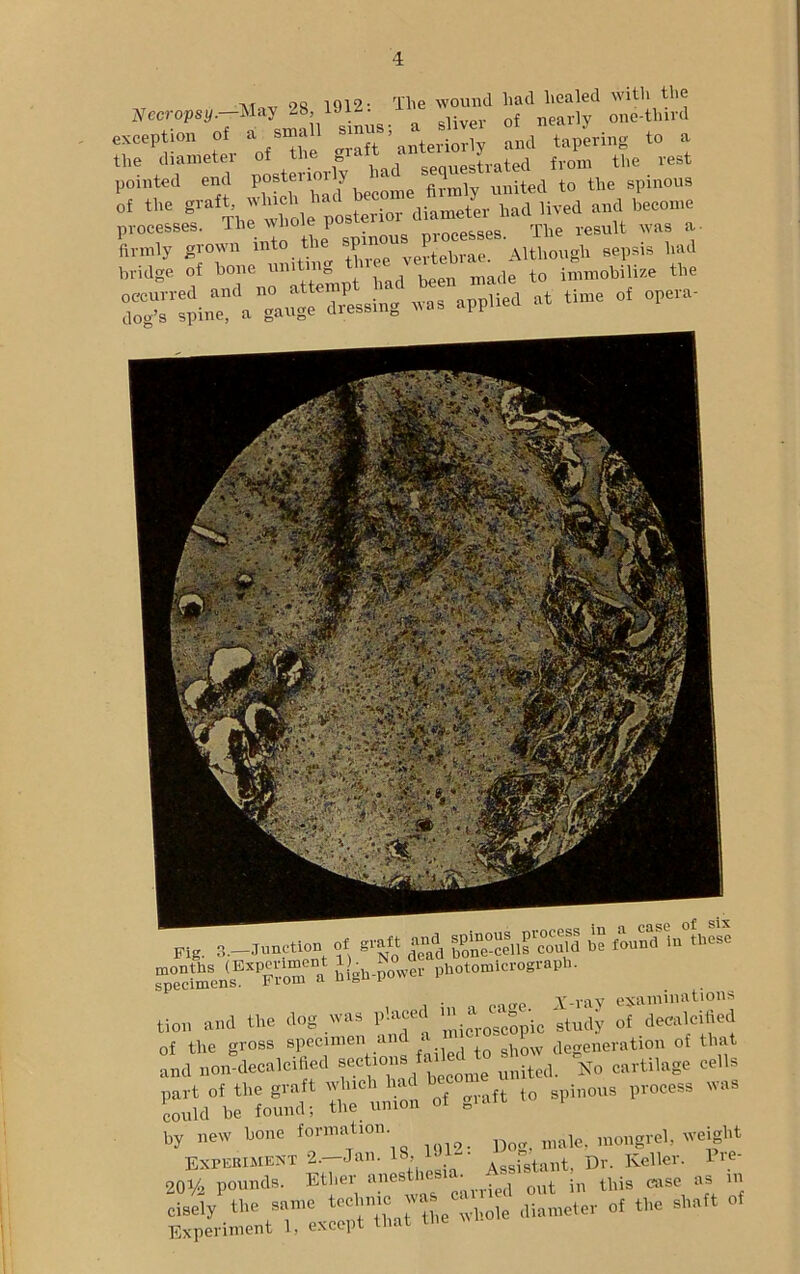 r 2S 1912 • The wound had healed with the Necropsy. May 28,' sliver 0f nearly one-tlnrd exception of a small ^^nterS and taking to a the diameter of the 0 ■ sequestrated from the rest pointed end postenoi y ‘ , united to the spinous f ,te srtlr,tzr;ivea „„<> processes, lhe wnoie i ,„ps The result was a- sr:i“:aa”^ .*sl* «■ ■««-°f °pe- Fig. 3.—Junction ol g.»« »J {SSiS'S S iUluttSS 5sa»l.E,,Kt“ i l in a cage. J-ray examinations tion and the dog was paced “ ic study of decalcified of the gross specimen and • degeneration of that and non decalcified Bectoon. failed4p * ^ cartilage cells S.-JMS!: »*• — — ”s 20% pounds. Ether anesthesia. A ^ ^ this ease as in cisely the same techxnc w| < diameter of the shaft of Experiment 1, except that the