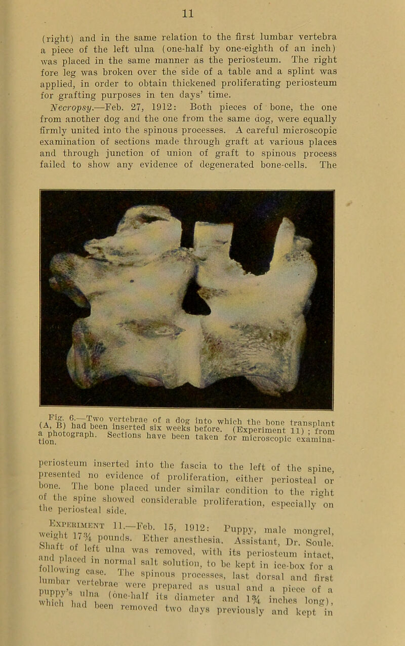 (right) and in the same relation to the first lumbar vertebra a piece of the left ulna (one-half by one-eighth of an inch) was placed in the same manner as the periosteum. The right fore leg was broken over the side of a table and a splint was applied, in order to obtain thickened proliferating periosteum for grafting purposes in ten days’ time. Necropsy.—Feb. 27, 1912: Both pieces of bone, the one from another dog and the one from the same dog, were equally firmly united into the spinous processes. A careful microscopic examination of sections made through graft at various places and through junction of union of graft to spinous process failed to show any evidence of degenerated bone-cells. The i AFio\ fL'T7riuW0 v.ertebrae of a dog into which the bone transplant (A, B) had been inserted six weeks before. (Experiment 11) • from ^photograph. Sections have been taken for Xo“copic examin” periosteum inserted into the fascia to the left of the spine presented no evidence of proliferation, either periosteal or bone I he bone placed under similar condition to the right of the spine showed considerable proliferation, especially on the periosteal side. ^ J 11rF?;i 15’ 1912: ma!e mongrel, Sl af o u/ ! Etl'er anesthesia- Assistant, Dr. Soule, and nine, U 1 7s removed> with its periosteum intact, follow!, ,n n07 Salt S01^011’ t0 be k€Pt « ice-box for a lumbar verteh J 9p,noua Processes, last dorsal and first Vertebrae were prepared as usual and a piece of a wldch hadh (°ne'half itS diameter and inches long), been removed two days previously and kept in
