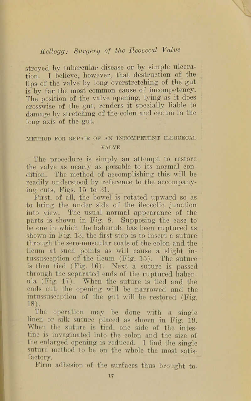 stroyed by tubercular disease or by simple ulcera- tion. I believe, however, that destruction of the lips of the valve by long overstretching of the gut is by far the most common cause of incompetency. The position of the valve opening, lying as it does crosswise of the gut, renders it specially liable to damage by stretching of the colon and cecum in the long axis of the gut. METHOD FOR REPAIR OF AN INCOMPETENT ILEOCECAL VALVE The procedure is simply an attempt to restore the valve as nearly as possible to its normal con- dition. The method of accomplishing this will be readily understood by reference to the accompany- ing cuts, Figs. 15 to 31. First, of all, the bowel is rotated upward so as to bring the under side of the ileocolic junction into view. The usual normal appearance of the parts is shown in Fig. 8. Supposing the case to be one in which the habenula has been ruptured as shown in Fig. 13, the first, step is to insert a suture through the sero-muscular coats of the colon and the ileum at such points as will cause a slight in- tussusception of the ileum (Fig. 15). The suture is then tied (Fig. 16). Next a suture is passed through the separated ends of the ruptured haben- ula (Fig. 17). When the suture is tied and the ends cut, the opening will be narrowed and the intussusception of the gut will be restored (Fig. 18). The operation may be done with a single linen or silk suture placed as shown in Fig. 19. When the suture is tied, one side of the intes- tine is invaginated into the colon and the size of the enlarged opening is reduced. 1 find the single suture method to be on the whole the most satis- factory. Firm adhesion of the surfaces thus brought to-
