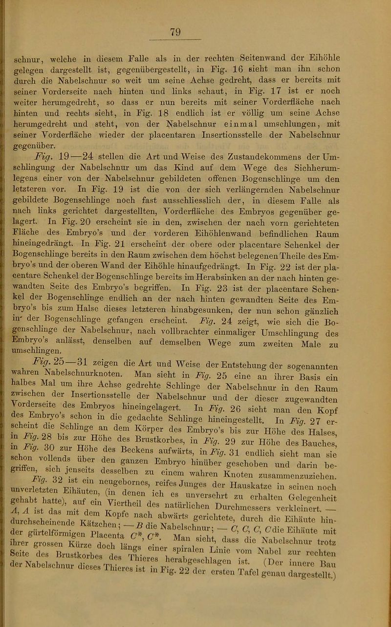 schnür, welche in diesem Falle als in der rechten Seitenwand der Eihöhle gelegen dargestellt ist, gegenübergestellt, in Fig. 16 sieht man ihn schon durch die Nabelschnur so weit um seine Achse gedreht, dass er bereits mit seiner Vorderseite nach hinten und links schaut, in Fig. 17 ist er noch weiter herumgedreht, so dass er nun bereits mit seiner Vorderfläche nach hinten und rechts sieht, in Fig. 18 endlich ist er völlig um seine Achse herumgedreht und steht, von der Nabelschnur einmal umschlungen, mit seiner Vorderfläche wieder der placentaren Insertionsstelle der Nabelschnur gegenüber. Fig. 19—24 stellen die Art und Weise des Zustandekommens der Um- schlingung der Nabelschnur um das Kind auf dem Wege des Sichherum- legens einer von der Nabelschnur gebildeten offenen Bogenschlinge um den letzteren vor. In Fig. 19 ist die von der sich verlängernden Nabelschnur gebildete Bogenschlinge noch fast ausschliesslich der, in diesem Falle als nach links gerichtet dargestellten, Vorderfläche des Embryos gegenüber ge- lagert. In Fig. 20 erscheint sie in den, zwischen der nach vorn gerichteten Fläche des Embryo’s und der vorderen Eihöhlenwand befindlichen Baum hineingedrängt. In Fig. 21 erscheint der obere oder placentare Schenkel der Bogenschlinge bereits in den Baum zwischen dem höchst belegenenTheile des Em- bryo’s und der oberen Wand der Eihöhle hinaufgedrängt. In Fig. 22 ist der pla- centare Schenkel der Bogenschlinge bereits im Herabsinken an der nach hinten ge- wandten Seite des Embryo’s begriffen. In Fig. 23 ist der placentare Schen- kel der Bogenschlinge endlich an der nach hinten gewandten Seite des Em- bryo s bis zum Halse dieses letzteren hinabgesunken, der nun schon gänzlich m' der Bogenschlinge gefangen erscheint. Fig. 24 zeigt, wie sich die Bo- genschhnge der Nabelschnur, nach vollbrachter einmaliger Umschlingung des Embryo’s anlässt, denselben auf demselben Wege zum zweiten Male zu : umschlingen. Fig. 2b 31 zeigen die Art und Weise der Entstehung der sogenannten wahren Nabeischnurknoten. Man sieht in Fig. 25 eine an ihrer Basis ein halbes Mal um ihre Achse gedrehte Schlinge der Nabelschnur in den Baum zwischen der Insertionsstelle der Nabelschnur und der dieser zugewandten Vorderseite des Embryos hineingelagert. In Fig. 26 sieht man den Kopf es Embryos schon in die gedachte Schlinge hineingestellt. In Fig. 27 er- in Ma 9R u ^ “ dem KörPer des Embryo’s bis zur Höhe des Halses, in Fia 30 TT'T/ T frUstkorbes’ in Fi9- 29 zur Höhe des Bauches, schon voLT u a nS aufwärts- in^-31 endlich sieht man sie griffen ich entT S“““ Embl7° Sescbobe» und darin be- Fia lst deSSG ben zu einem wahren Knoten zusammenzuziehen. un^erktzten^Eihäutpnn^■1^e^0rneS, ,r^es dun8es der Hauskatze in seinen noch gehabt litte aTein V’ TT r * 68 UnVersehrt zu «halten Gelegenheit * A ist dal’it do r7 f iS natMichen Durchmessers verkleinert. - durchscheinende kTJIu-TäietTT ^ T “ der gürtelförmigen Placenta C* C* mT l a ^ C’. C’ Cdie Eihäute mit ihrer urossen Kür^o a i v. ’ . ' dan sie^t, dass die Nabelschnur trotz Seite des Brustkorbes° d^s^ier“““ Spil-alen kinic Nabel zur rechten der Nabelschnur dieses Thieres ist b! herfee3chlaSon ,st. (Der innere Bau 1 hie,es ist in Fig. 22 der ersten Tafel genau dargestellt.)