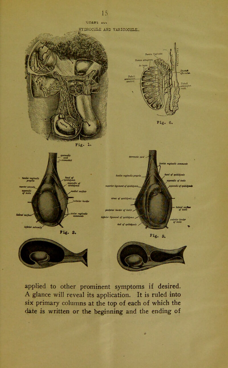 'Una&'c jlw* Fig. 1. VARICOCELE.. Fig. 6. Fig. 2. tanka vaginalis propria posterior border oj lestif inferior ligament of epididymis tail of epididymis Fig. 3. anterior border of testis > applied to other prominent symptoms if desired. A glance will reveal its application. It is ruled into six primary columns at the top of each of which the date is written or the beginning and the ending of