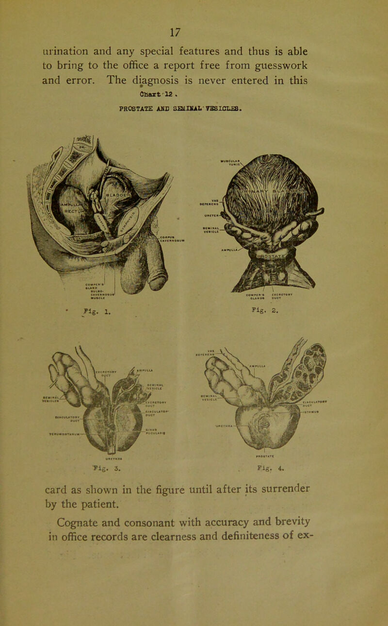 -~+r-> V'_ urination and any special features and thus is able to bring to the office a report free from guesswork and error. The diagnosis is never entered in this Chart 12 . PROSTATE AMD SHiUlAI. VESICLES. fig. 1. Pig. 2. B LAOOI .RECTI Tig. 3. Pig, 4. card as shown in the figure until after its surrender by the patient. Cognate and consonant with accuracy and brevity in office records are clearness and definiteness of ex-