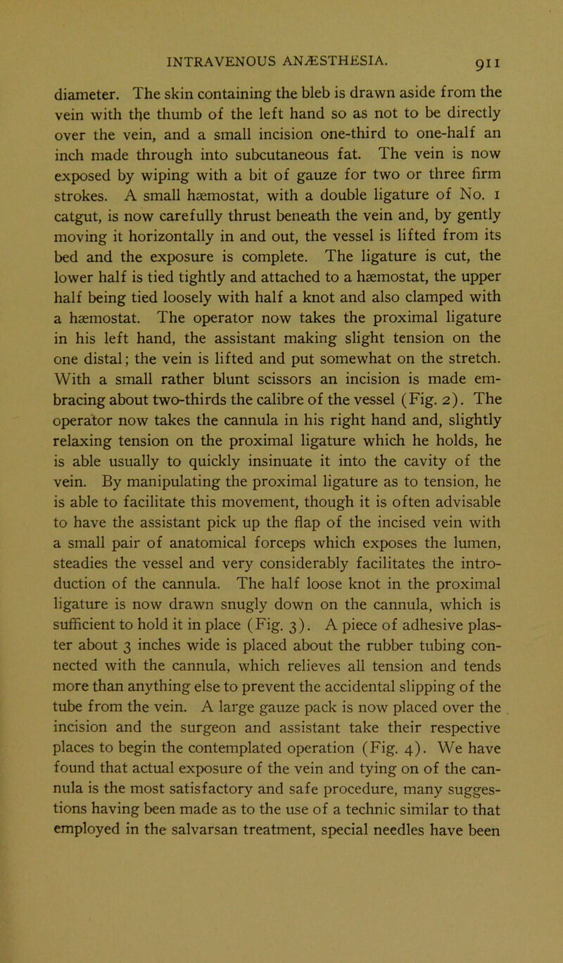 diameter. The skin containing the bleb is drawn aside from the vein with the thumb of the left hand so as not to be directly over the vein, and a small incision one-third to one-half an inch made through into subcutaneous fat. The vein is now exposed by wiping with a bit of gauze for two or three firm strokes. A small hsemostat, with a double ligature of No. 1 catgut, is now carefully thrust beneath the vein and, by gently moving it horizontally in and out, the vessel is lifted from its bed and the exposure is complete. The ligature is cut, the lower half is tied tightly and attached to a hsemostat, the upper half being tied loosely with half a knot and also clamped with a haemostat. The operator now takes the proximal ligature in his left hand, the assistant making slight tension on the one distal; the vein is lifted and put somewhat on the stretch. With a small rather blunt scissors an incision is made em- bracing about two-thirds the calibre of the vessel (Fig. 2). The operator now takes the cannula in his right hand and, slightly relaxing tension on the proximal ligature which he holds, he is able usually to quickly insinuate it into the cavity of the vein. By manipulating the proximal ligature as to tension, he is able to facilitate this movement, though it is often advisable to have the assistant pick up the flap of the incised vein with a small pair of anatomical forceps which exposes the lumen, steadies the vessel and very considerably facilitates the intro- duction of the cannula. The half loose knot in the proximal ligature is now drawn snugly down on the cannula, which is sufficient to hold it in place (Fig. 3). A piece of adhesive plas- ter about 3 inches wide is placed about the rubber tubing con- nected with the cannula, which relieves all tension and tends more than anything else to prevent the accidental slipping of the tube from the vein. A large gauze pack is now placed over the incision and the surgeon and assistant take their respective places to begin the contemplated operation (Fig. 4). We have found that actual exposure of the vein and tying on of the can- nula is the most satisfactory and safe procedure, many sugges- tions having been made as to the use of a technic similar to that employed in the salvarsan treatment, special needles have been