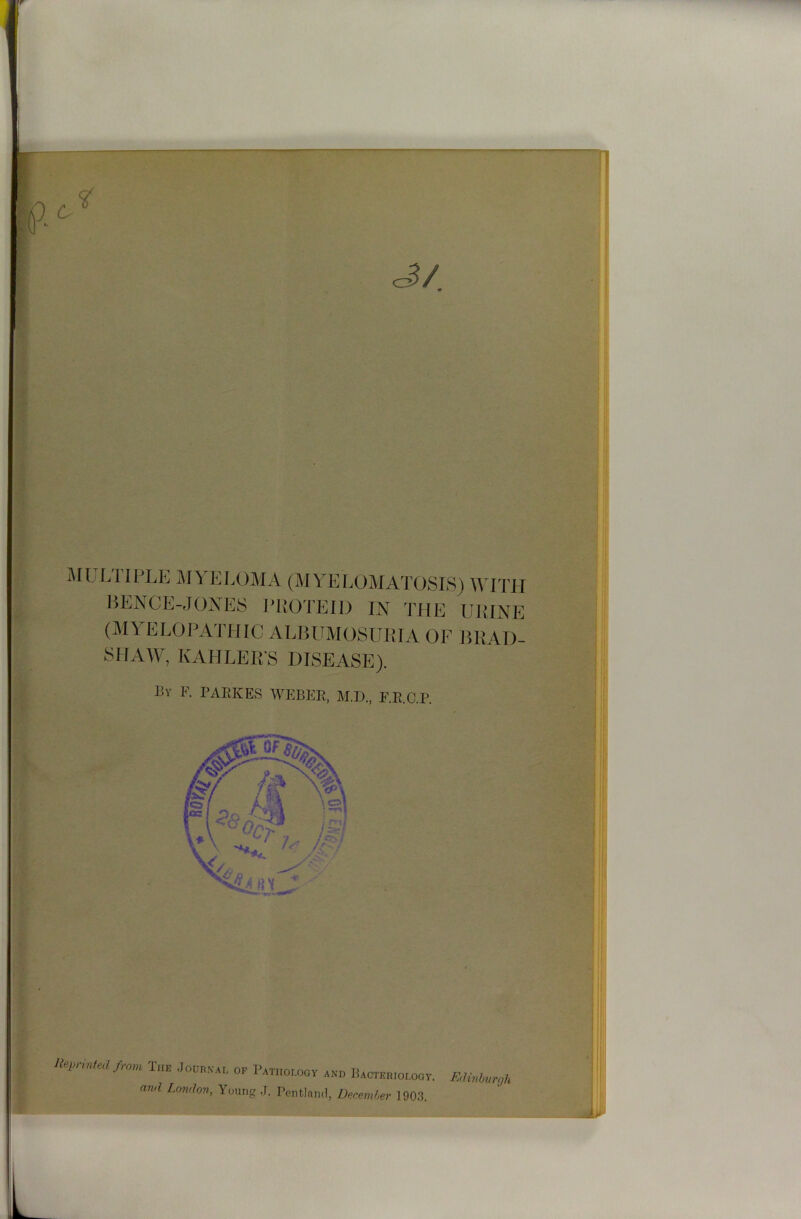 6 <3/ JH LTIPLE MYELOMA (MYELOMATOSIS) WITH BENCE-JONES RBOTEID IN THE UIIINE (MYELOPATHIC ALBUMOSURIA OF BRAD- SHAW, KAHLERS DISEASE). By F. PAIiKES WEBEH, M.D., F.E.O.P. Crimea from The Jouhnal of Pathology and Bactemology. and London, Young J. Pcntlami, December 1903.