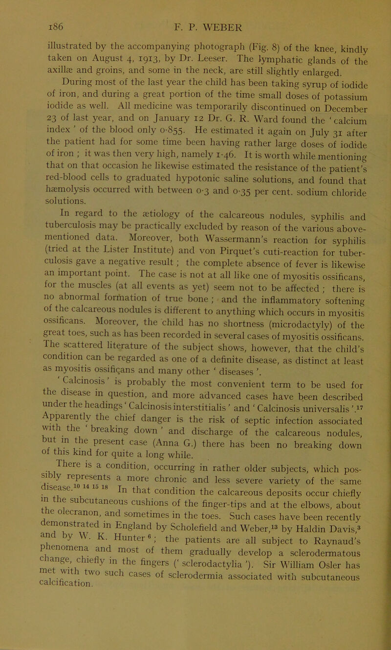 illustrated by the accompanying photograph (Fig. 8) of the knee, kindly taken on August 4, 1913, by Dr. Leeser. The lymphatic glands of the axillae and groins, and some in the neck, are still slightly enlarged. During most of the last year the child has been taking syrup of iodide of iron, and during a great portion of the time small doses of potassium iodide as well. All medicine was temporarily discontinued on December 23 of last year, and on January 12 Dr. G. R. Ward found the ‘calcium index ’ of the blood only 0-855. He estimated it again on July 31 after the patient had for some time been having rather large doses of iodide of iron ; it was then very high, namely 1-46. It is worth while mentioning that on that occasion he likewise estimated the resistance of the patient’s red-blood cells to graduated hypotonic saline solutions, and found that haemolysis occurred with between 0-3 and 0-35 per cent, sodium chloride solutions. In regard to the aetiology of the calcareous nodules, svphilis and tuberculosis may be practically excluded by reason of the various above- mentioned data. Moreover, both Wassermann’s reaction for syphilis (tried at the Lister Institute) and von Pirquet’s cuti-reaction for tuber- culosis gave a negative result; the complete absence of fever is likewise an important point. The case is not at all like one of myositis ossificans, for the muscles (at all events as yet) seem not to be affected ; there is no abnormal formation of true bone ; and the inflammatory softening of the calcareous nodules is different to anything which occurs in myositis ossificans. Moreover, the child has no shortness (microdactyly) of the great toes, such as has been recorded in several cases of myositis ossificans. The scattered literature of the subject shows, however, that the child’s condition can be regarded as one of a definite disease, as distinct at least as myositis ossificans and many other ‘ diseases ’. Calcinosis is probably the most convenient term to be used for the disease in question, and more advanced cases have been described under the headings ‘ Calcinosis interstitialis ’ and ' Calcinosis universalis ’,17 pparently the chief danger is the risk of septic infection associated viti the breaking down and discharge of the calcareous nodules, ut m the present case (Anna G.) there has been no breaking down of this kind for quite a long while. There is a condition, occurring in rather older subjects, which pos- d' V a more chronic and less severe variety of the same . lsease- 8 In that condition the calcareous deposits occur chiefly in the subcutaneous cushions of the finger-tips and at the elbows, about e o ecranon, and sometimes in the toes. Such cases have been recently demonstrated in England by Scholefield and Weber,13 by Haldin Davis,3 ^ Hunter6; the patients are all subject to Raynaud's phenomena and most of them gradually develop a sclerodermatous ange c neflv in the fingers (‘sclerodactylia’). Sir William Osier has \\i two such cases of sclerodermia associated with subcutaneous