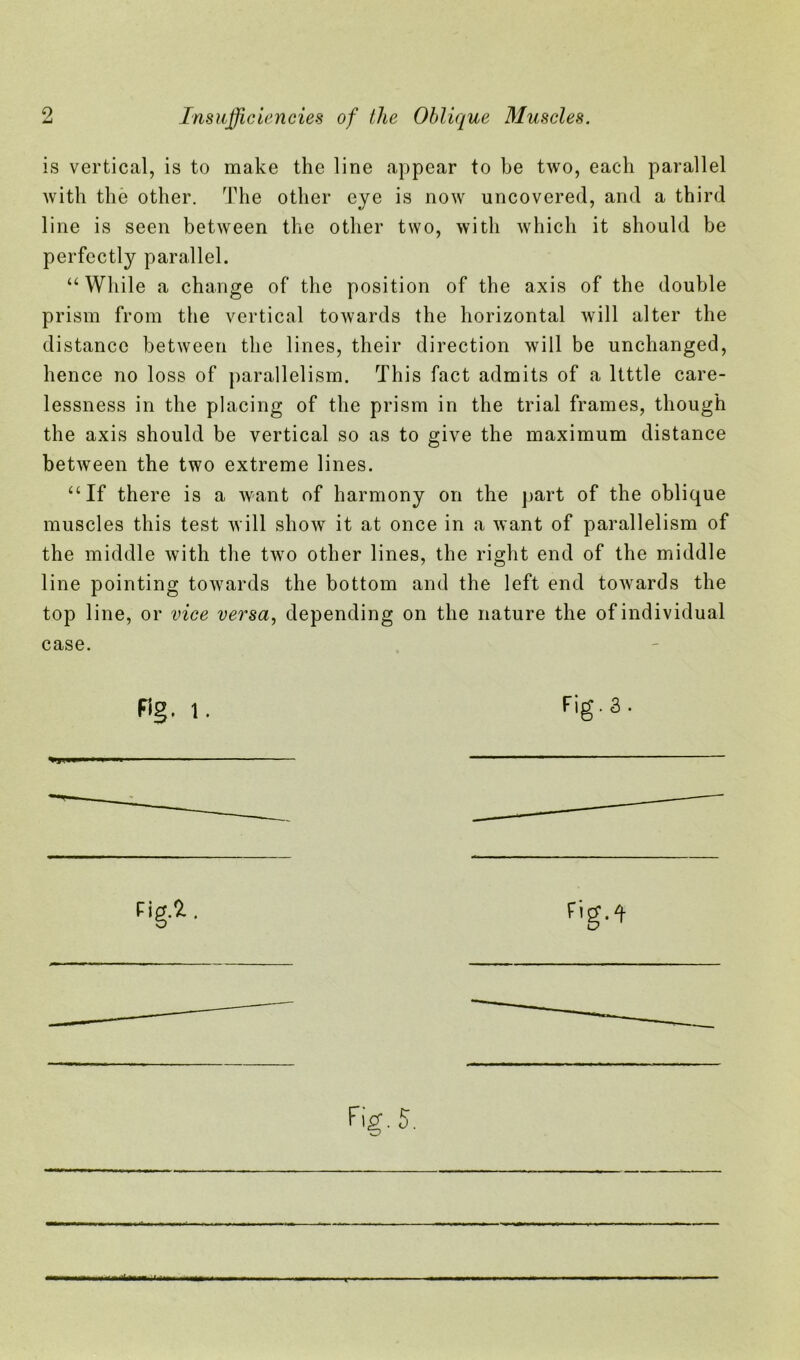 is vertical, is to make the line appear to be two, each parallel with the other. The other eye is now uncovered, and a third line is seen between the other two, with which it should be perfectly parallel. “While a change of the position of the axis of the double prism from the vertical towards the horizontal will alter the distance between the lines, their direction will be unchanged, hence no loss of parallelism. This fact admits of a ltttle care- lessness in the placing of the prism in the trial frames, though the axis should be vertical so as to give the maximum distance between the two extreme lines. “If there is a want of harmony on the part of the oblique muscles this test will show it at once in a want of parallelism of the middle with the two other lines, the right end of the middle line pointing towards the bottom and the left end towards the top line, or vice versa, depending on the nature the of individual case. Fig.3. Fig.*.