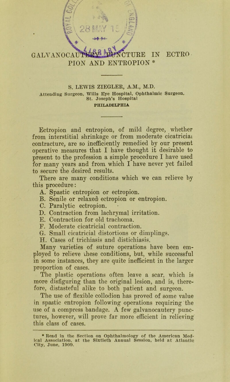 PION AND ENTROPION * S. LEWIS ZIEGLER, A.M., M.D. Attending Surgeon, Wills Eye Hospital, Ophthalmic Surgeon, St. Joseph’s Hospital PHILADELPHIA Ectropion and entropion, of mild degree, whether from interstitial shrinkage or from moderate cicatriciai contracture, are so inefficiently remedied by our present operative measures that I have thought it desirable to present to the profession a simple procedure I have used for many years and from which I have never yet failed to secure the desired results. There are many conditions which we can relieve by this procedure: A. Spastic entropion or ectropion. B. Senile or relaxed ectropion or entropion. C. Paralytic ectropion. D. Contraction from lachrymal irritation. E. Contraction for old trachoma. F. Moderate cicatricial contraction. G. Small cicatricial distortions or dimplings. H. Cases of trichiasis and distichiasis. Many varieties of suture operations have been em- ployed to relieve ihese conditions, but, while successful in some instances, they are quite inefficient in the larger proportion of cases. The plastic operations often leave a scar, which is more disfiguring than the original lesion, and is, there- fore, distasteful alike to both patient and surgeon. The use of flexible collodion has proved of some value in spastic entropion following operations requiring the use of a compress bandage. A few galvanocautery punc- tures, however, will prove far more efficient in relieving this class of cases. • Read in the Section on Ophthalmology of the American Med- ical Association, at the Sixtieth Annual Session, held at Atlantic City, June, 1909.