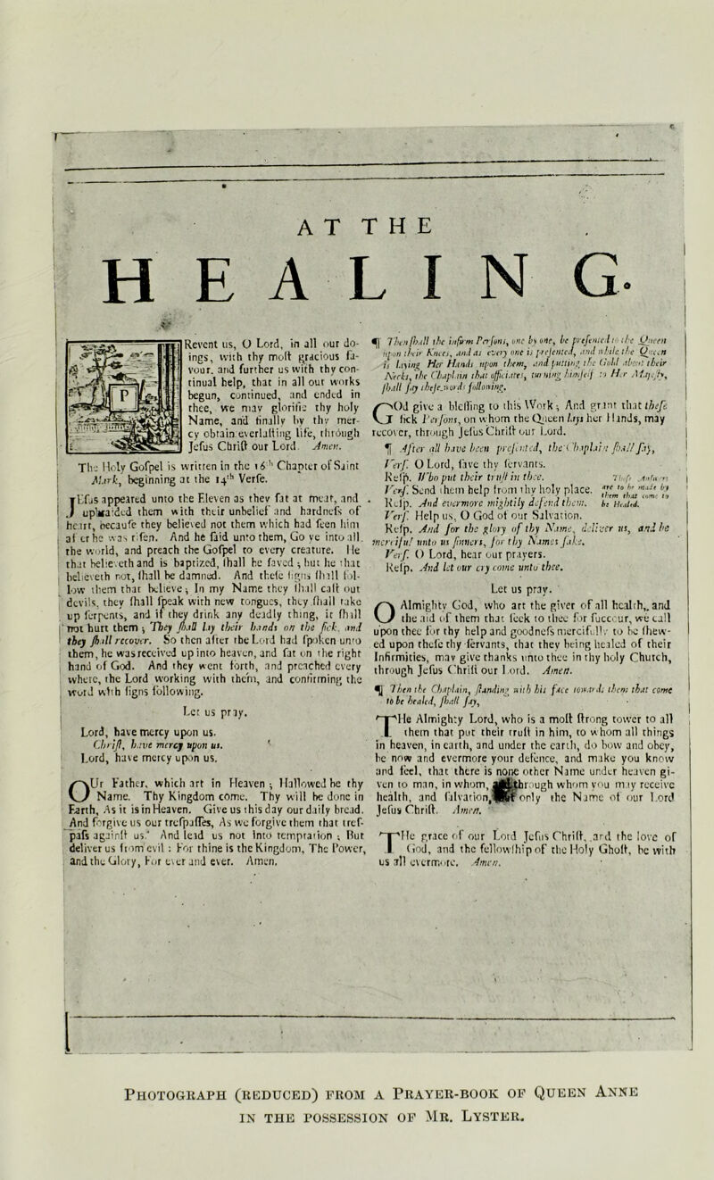 AT THE H E A L I N G Revcnt us, O Lord, in all our do- ings, with thy molt gracious fa- vour. and further us with thy con- tinual help, that in all out works begun, continued, and ended in thee, we mav gloritle thy holy Name, and finally hv thv mer- cy obtain.u\ crlalting life, through Jefus Cbrilt our Lord. Amen. The Holy Gofpel is written in the 16 '' Chapter of Saint Mirk, beginning at the t4,h Verfe. ILfiS appeared unto the Eleven as they fat at meat, and upl*a:ded them with their unbelief and hardnefs of heart, oecaufe they believed not them which had feen him af trhe was rifert. And he faid unto them. Go ve into all. the world, and preach the Gofpel to every creature, lie that belie.ethand is baptized, (ball he faved ; hut he hat believeth not, I hall be damned. And theic ligns fh ill f >1- low them tbar believe; In my Name they (ball call out devils, they (hall lipeak wirh new tongues, they (hull take up ferpents, and if they drink any deadly thing, it (hill not hurt them They /lull hy their hands on the lick. and they /h ill recover. So then after the Lord had fpoken umo them, he was received up into heaven, and fat on the right hand of God. And they went forth, and preached every where, the Lord working with them, and confirming the word with ligns following. Let us pray. Lord, have mercy upon us. Chri/I, h.ivt mercy upon us. Lord, have mctcy upon us. OUr Father, which art in Heaven; Hallowed he thy Name. Thy Kingdom come. Thy will he done in Earth, As it is in Heaven. Give us this day our daily bread. And forgive us our treCpjfTes, As we forgive them that tref- pafs againlt us.‘ And lead us not into temptation ; Hut deliver us from evil: For thine is the Kingdum, The Power, and the Glory, For ever and ever. Amen, ^1 Thenjh.d! the infirm Pcrjons, one by one, be prtfoue.li the Oiteeti up.m then Kncc>, Mil els ever) one i, prcjeuicd, .'.ml while the Oe.n is laying Her Hindi upon them, and putting the (loU tb ■' their Necks, the Ch.ipl.im that officiate!, turning himjeif M H r Attjeh, /hall /.ry ibeje.n inch following, GOd give a hlclfing to this Work ; And grant that thefc fick 1‘erjbns, on whom the Queen lays her Hinds, may recover, through Jefus thrift our Lord. After <i!l have been prcjiiited, thc i hapla'ni fi.il/ fay, I 'erf. OLord, five thy fervants. Kelp, irbo put their trii/l in thee. .info s Vcrf Send them help from thv holy place, Je 10'‘J'b> * Ki.Jp. Jud evcYvioYC mightily dc[ei:d them, b: Verf. Help us, O God of our Salvation. Kelp. And for the glory of thy Name, deliver us, and he Inert iju! unto us /sutlers, for thy Names fake. Verf. () Lord, hear our prayers. Kelp. And let our cry come unto thee. Let us pray. O Almighty God, who art the giver of all health,, and the aid of them that leek to thee f >r fuccvur, we call upon thee for rhy help and goodnefs merciful!.• to he (hew- ed upon thcle rhy fervants, that they being healed of their Infirmities, mav give thanks utito thee in thy holy Church, through Jefus Chrili our Lord. Amen. Then the Chaplain, (landing niih hit face towards them that come to be healed, /hall fay, Tile Almighty Lord, who is a molt ftrong tower to all them that put their truli in him, to whom all things in heaven, in earth, and under the earth, do bow and obey, be now and evermore your defence, and make you know and feel, that there is none other Name under heaven gi- ven to man, in whom, ^Lthrough whom you iti iy receive health, and falvation,IKif only the Name of our l ord Jefus Chrilt. A men. Tile grace of our Lord Jefus Chrift, .ard the love of God, and the fellowlhip of the Holy Gholt, he with us all cvercru ire. Amen. Photograph (reduced) from a Prayer-book of Queen Anne IN THE POSSESSION OF MR. LYSTER.