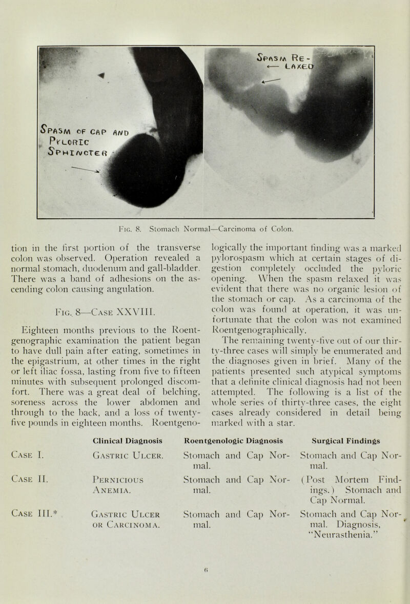 tion in the first portion of the transverse colon was observed. Operation revealed a normal stomach, duodenum and gall-bladder. There was a band of adhesions on the as- cending colon causing angulation. Fig. 8—-Case XXVIIF Eighteen months previous to the Roent- genographic examination the patient began to have dull pain after eating, sometimes in the epigastrium, at other times in the right or left iliac fossa, lasting from five to fifteen minutes with subsequent prolonged discom- fort. There was a great deal of belching, soreness across the lower abdomen and through to the back, and a loss of twenty- five pounds in eighteen months. Roentgeno- logically the important finding was a marked pylorospasm which at certain stages of di- gestion completely occluded the pyloric opening. When the spasm relaxed it was evident that there was no organic lesion of the stomach or cap. As a carcinoma of the colon was found at operation, it was un- fortunate that the colon was not examined Roentgenographically. The remaining twenty-five out of our thir- ty-three cases will simply be enumerated and the diagnoses given in brief. Many of the patients presented such atypical symptoms that a definite clinical diagnosis had not been attempted. The following is a list of the whole series of thirty-three cases, the eight cases already considered in detail being marked with a star. Clinical Diagnosis Roentgenologic Diagnosis Surgical Findings Case I. Gastric Ulcer. Stomach and Cap Nor- Stomach and Cap Nor- mal. mal. Case II. Pernicious Stomach and Cap Nor- (Post Mortem Find- Anemia. mal. ings.) Stomach and Cap Normal. Case III.* Gastric Ulcer Stomach and Cap Nor- Stomach and Cap Nor- or Carcinoma. mal. mal. Diagnosis, “Neurasthenia.”