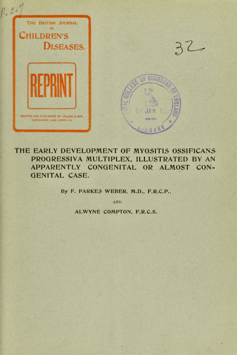 THE EARLY DEVELOPMENT OF MYOSITIS OSSIFICANS PROGRESSIVA MULTIPLEX, ILLUSTRATED BY AN APPARENTLY CONGENITAL OR ALMOST CON- GENITAL CASE. By F. PARKES WEBER, M.D., F.R.C.P., AND ALWYNE COMPTON, F.R.C.S.