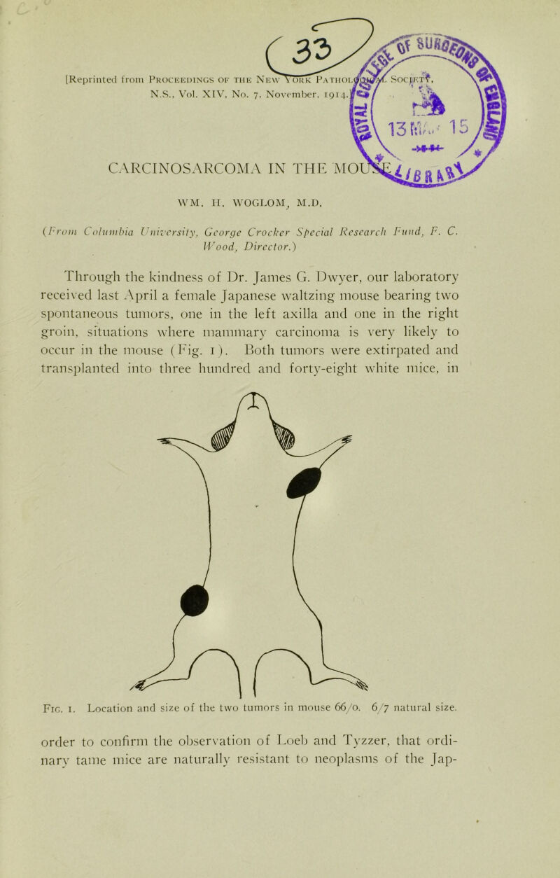 [Reprinted from Proceedings of the New York Patho: N.S., Vol. XIV, No. 7, November, 1914. CARCINOSARCOMA IN THE M< WM. II. WOGLOM, M.D. (From C olumbia University, George Crocker Special Research Fund, F. C. Wood, Director.) Through the kindness of Dr. James G. Dwyer, our laboratory received last April a female Japanese waltzing mouse bearing two spontaneous tumors, one in the left axilla and one in the right groin, situations where mammary carcinoma is very likely to occur in the mouse (big. 1). Both tumors were extirpated and transplanted into three hundred and forty-eight white mice, in Fig. 1. Location and size of the two tumors in mouse 66/0. 6/7 natural size. order to confirm the observation of Loeb and Tyzzer, that ordi- nary tame mice are naturally resistant to neoplasms of the Jap-