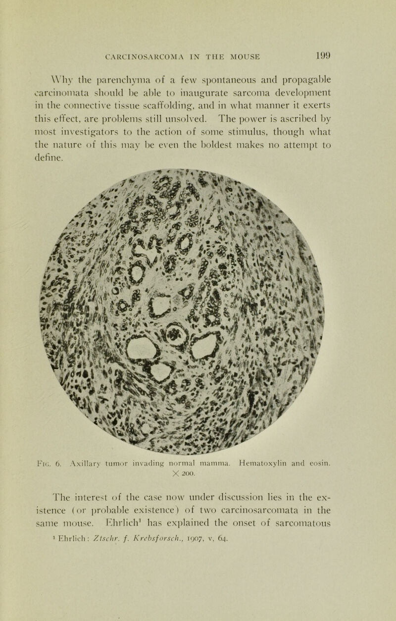 Why the parenchyma of a few spontaneous and propagable carcinomata should he able to inaugurate sarcoma development in the connective tissue scaffolding, and in what manner it exerts this effect, are problems still unsolved. The power is ascribed by most investigators to the action of some stimulus, though what the nature of this may be even the boldest makes no attempt to define. Fig. 6. Axillary tumor invading normal mamma. Hematoxylin and eosin. X 200. The interest of the case now under discussion lies in the ex- istence (or probable existence) of two carcinosarcomata in the same mouse. Khrlich1 has explained the onset of sarcomatous 1 Ehrlich: Ztschr. f. Krcbsforsch., 1907, v, 64.