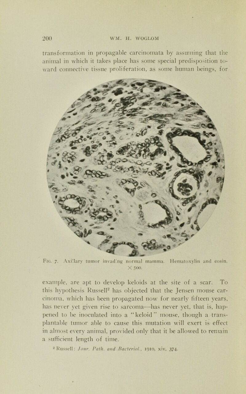 transformation in propagable carcinomata by assuming that the animal in which it takes place has some special predisposition to- ward connective tissue proliferation, as some human beings, for Fig. 7. Axillary tumor invading normal mamma. Hematoxylin and eosin. X 500. example, are apt to develop keloids at the site of a scar. To this hypothesis Russell2 has objected that the Jensen mouse car- cinoma, which has been propagated now for nearly fifteen years, has never yet given rise to sarcoma—has never yet, that is, hap- pened to be inoculated into a “keloid mouse, though a trans- plantable tumor able to cause this mutation will exert is effect in almost every animal, provided only that it be allowed to remain a sufficient length of time. 2 Russell: Jour. Path, and Bactcriol.. iqio, xiv, 374.