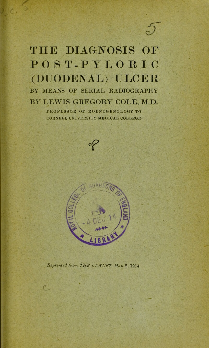 >1 THE DIAGNOSIS OF PO S T.P YLO RIG (DUODENAL) ULCER BY MEANS OF SERIAL RADIOGRAPHY BY LEWIS GREGORY COLE, M.D. PROFESSOR OF ROENTGENOLOGY TO CORNELL UNIVERSITY MEDICAL COLLEGE <f Beprinted from. 2HE LANCET, May 2. 1914 % • r -