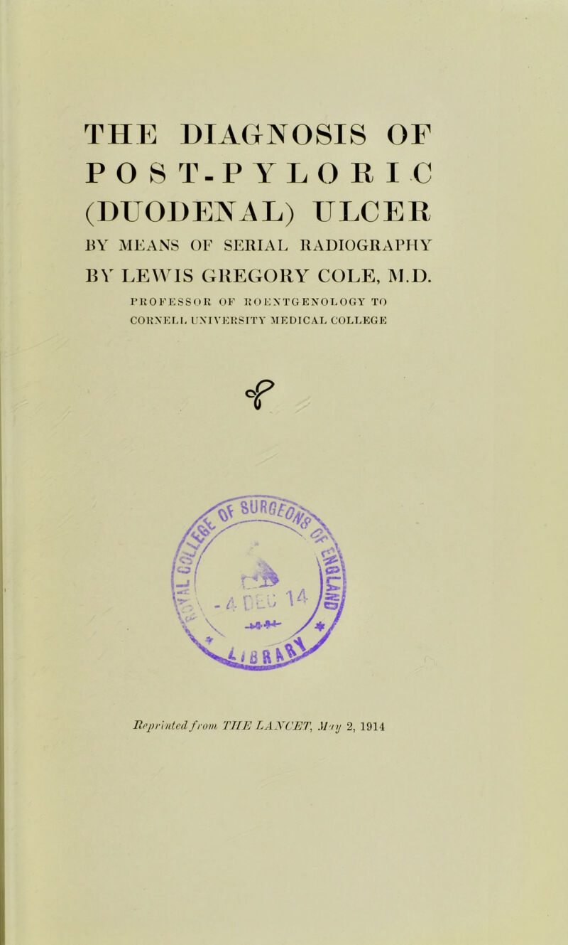 THE DIAGNOSIS OF POST-PYLORIC (DUODENAL) ULCER RY MEANS OF SERIAL RADIOGRAPHY BV LEWIS GREGORY COLE, M.D. rilOFESSOR OF ROENTGENOLOGY TO CORNELL UNIVERSITY :\IEDICAL COLLEGE TtopvintciL f rom. THE LAXCET^ Muy 2, 1914