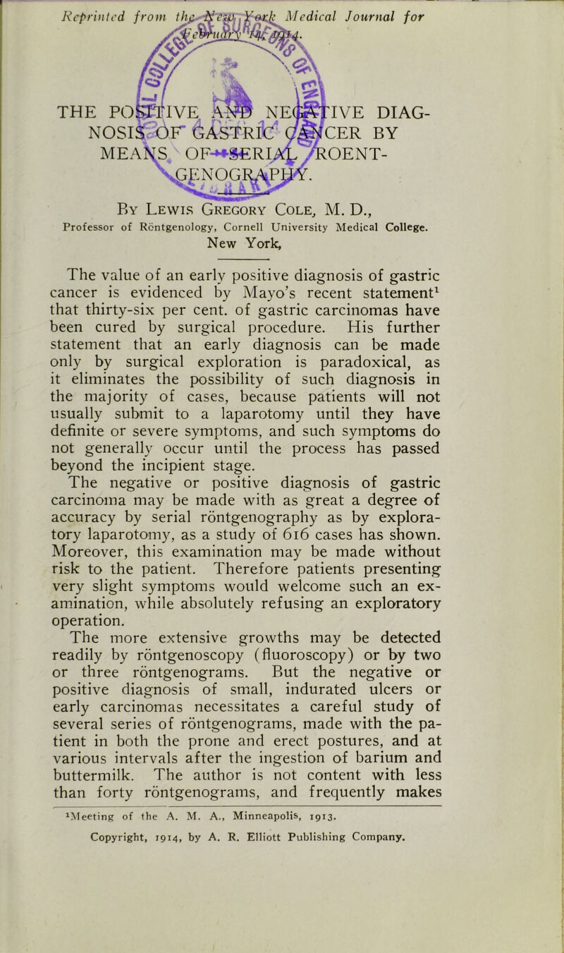 Reprinted from thg, /ah # THE PC Medical Journal for 'IVE DIAG- CER BY NOSIS OF GASTRIC MEANS OF-**$£RIAL AROENT- By Lewis Gregory Cole, M. D., Professor of Rontgenology, Cornell University Medical College. New York, The value of an early positive diagnosis of gastric cancer is evidenced by Mayo’s recent statement1 that thirty-six per cent, of gastric carcinomas have been cured by surgical procedure. His further statement that an early diagnosis can be made only by surgical exploration is paradoxical, as it eliminates the possibility of such diagnosis in the majority of cases, because patients will not usually submit to a laparotomy until they have definite or severe symptoms, and such symptoms do not generally occur until the process has passed beyond the incipient stage. The negative or positive diagnosis of gastric carcinoma may be made with as great a degree of accuracy by serial rontgenography as by explora- tory laparotomy, as a study of 616 cases has shown. Moreover, this examination may be made without risk to the patient. Therefore patients presenting very slight symptoms would welcome such an ex- amination, while absolutely refusing an exploratory operation. The more extensive growths may be detected readily by rontgenoscopy (fluoroscopy) or by two or three rontgenograms. But the negative or positive diagnosis of small, indurated ulcers or early carcinomas necessitates a careful study of several series of rontgenograms, made with the pa- tient in both the prone and erect postures, and at various intervals after the ingestion of barium and buttermilk. The author is not content with less than forty rbntgenograms, and frequently makes 1Meeting of the A. M. A., Minneapolis, 1913. Copyright, 1914, by A. R. Elliott Publishing Company.