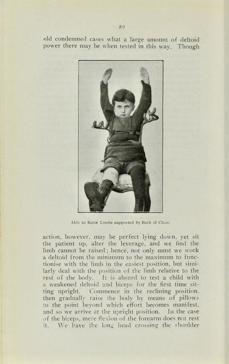 Mel condemned cases what a large amount of deltoid power there may be when tested in this way. Though Able to Raise Limbs supported by Back of Chair. action, however, may be perfect lying down, yet sit the patient up, alter the leverage, and we find the limb cannot be raised ; hence, not only must we work a deltoid from the minimum to the maximum to func- tionise with the limb in the easiest position, but simi- larly deal with the position of the limb relative to the rest of the body. It is absurd to test a child with a weakened deltoid and biceps for the first time sit- ting upright. Commence in the reclining position, then gradually raise the body by means of pillows to the point beyond which effort becomes manifest, and so we arrive at the upright position. In the case of the biceps, mere flexion of the forearm does not rest it. We have the long head crossing the shoulder