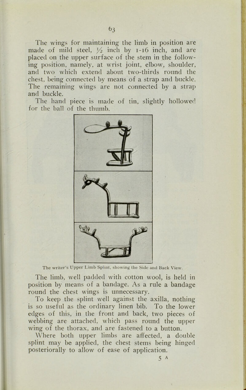 ^3 'The wings for maintaining the limb in position are made of mild steel, ]/i inch by 1-16 inch, and are placed on the upper surface of the stem in the follow- ing position, namely, at wrist joint, elbow, shoulder, and two which extend about two-thirds round the chest, being connected by means of a strap and buckle. The remaining wings are not connected by a strap and buckle. The hand piece is made of tin, slightly hollowed for the ball of the thumb. The writer's Upper Limb Splint, showing the Side and Back View. The limb, well padded with cotton wool, is held in position by means of a bandage. As a rule a bandage round the chest wings is unnecessary. To keep the splint well against the axilla, nothing is so useful as the ordinary linen bib. To the lower edges of this, in the front and back, two pieces of webbing are attached, which pass round the upper wing of the thorax, and are fastened to a button. Where both upper limbs are affected, a double splint may be applied, the chest stems being hinged posteriorally to allow of ease of application. 5 A