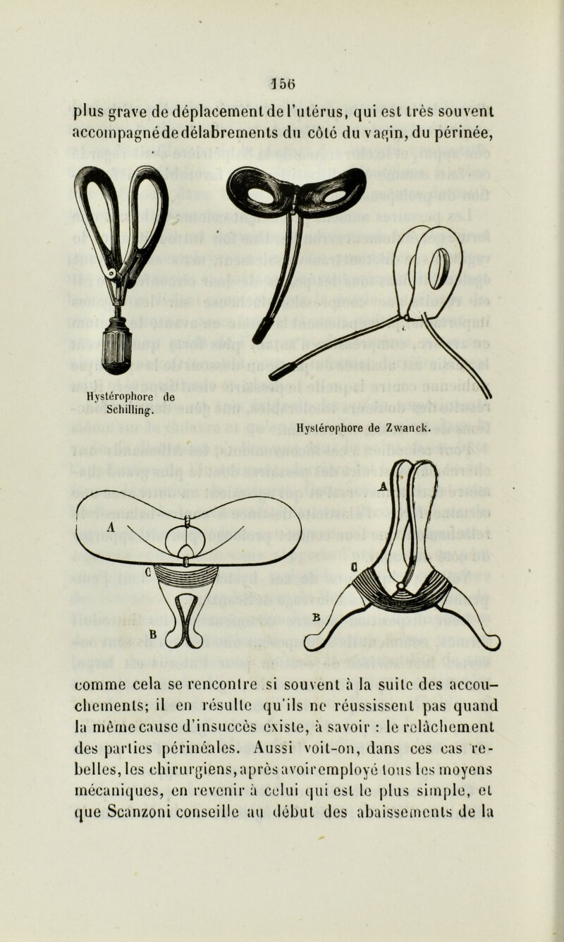 plus grave de déplacement de rutérus, qui est très souvent accompagnédedélabrements du côte du vagin, du périnée, Hystérophore de Schilling. Hystérophore de Zvvanck. comme cela se rencontre si souvent à la suite des accou- chements; il en résulte qu’ils ne réussissent pas quand la même cause d’insuccès existe, à savoir : le relâchement des parties périnéales. Aussi voit-on, dans ces cas re- belles, les chirurgiens,après avoiremployé tous les moyens mécaniques, en revenir à celui qui est le plus simple, et que Scanzoni conseille au début des abaissements de la