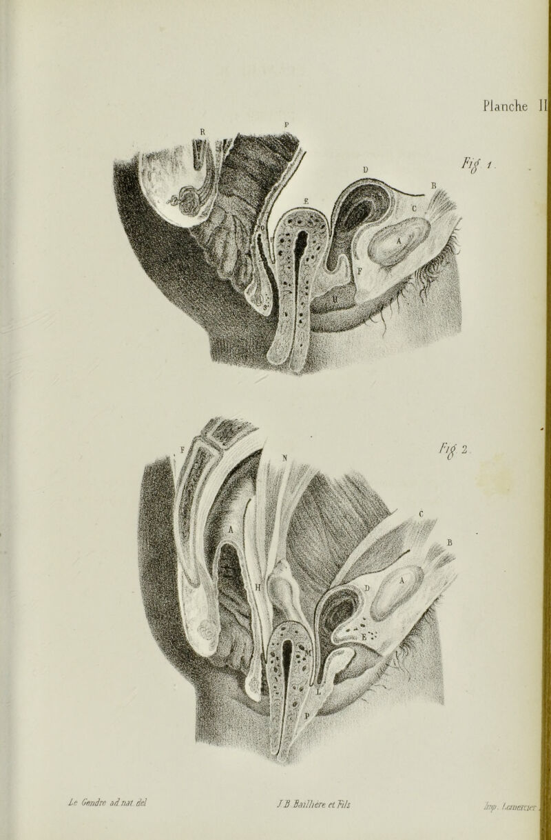 Le Cendre ad.Jiat.dd lmp. /.cjiiemcr. JB Baillière et FiJs