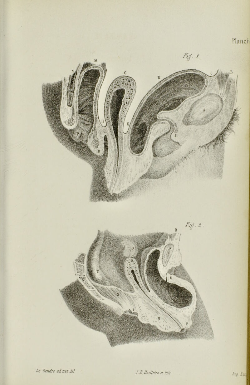 Le Gendre âd nat del h un len